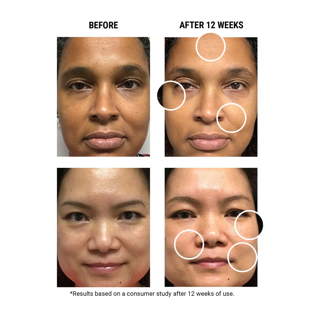 Micro-Dose Anti-Aging Retinol Serum With Ceramides and Peptide - Image 5