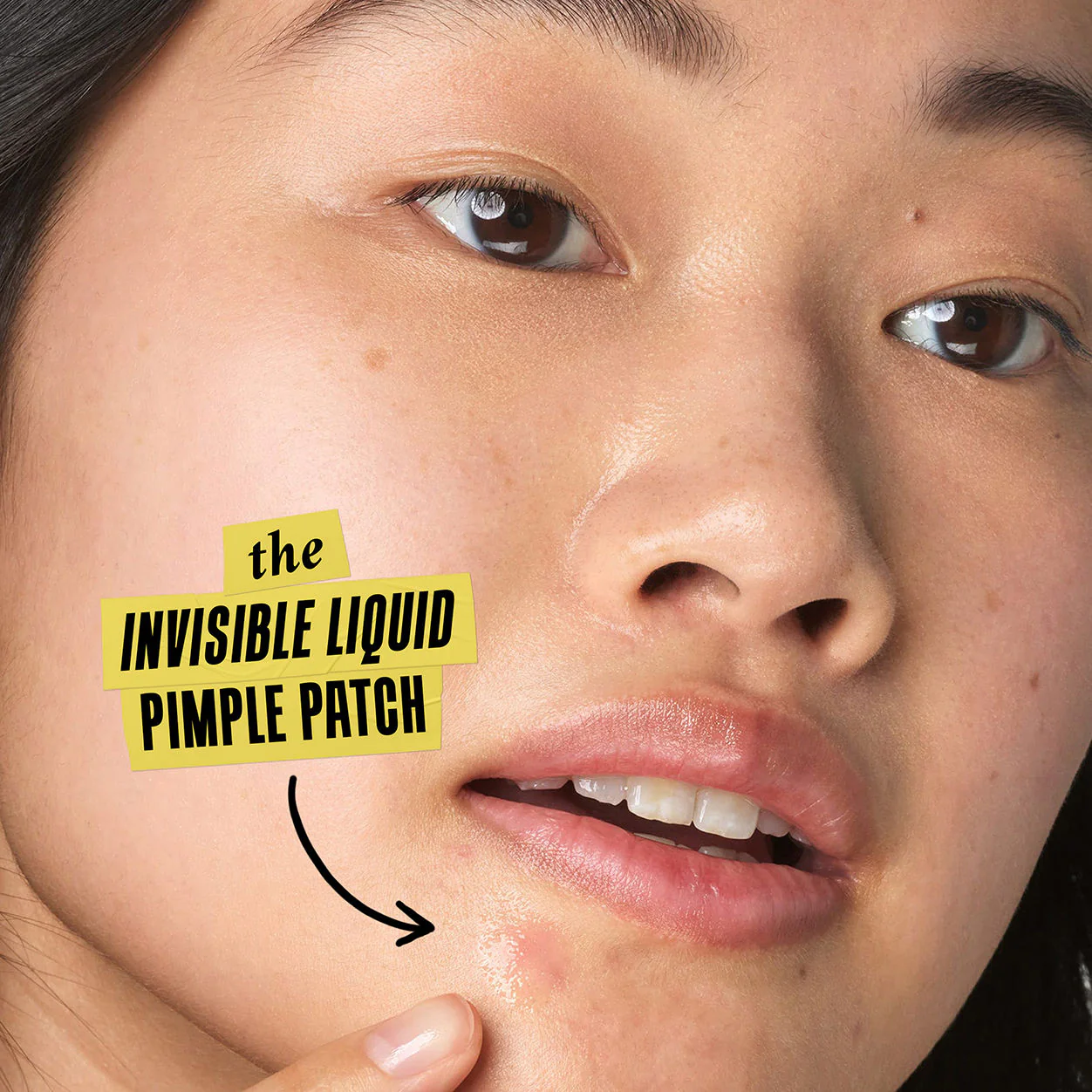 Truly Targeted Acne-Clearing Solution - Image 5