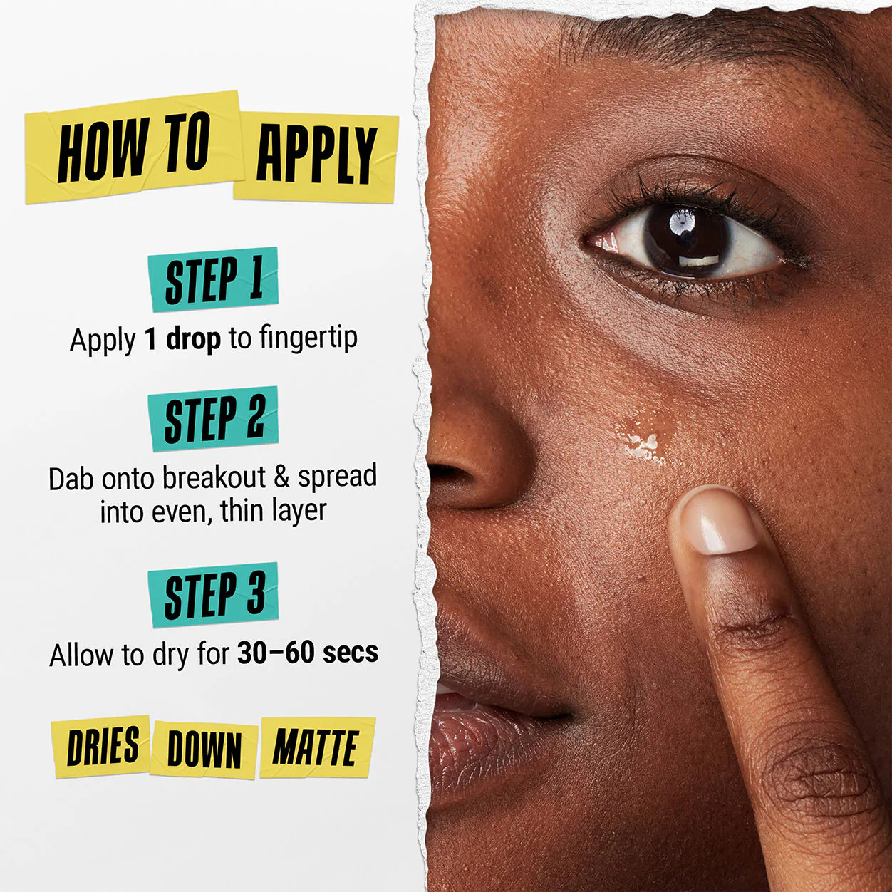 Truly Targeted Acne-Clearing Solution - Image 9