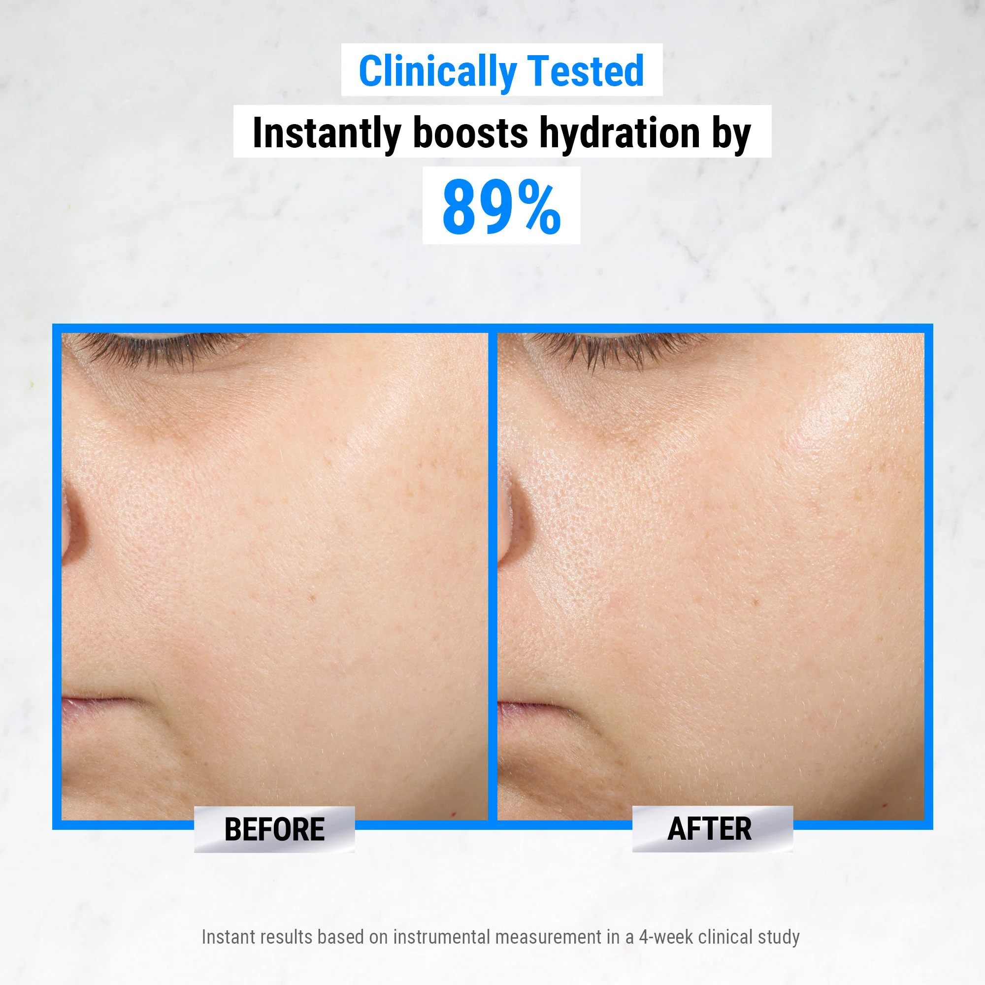 Ultra Pure High-Potency 1.5% Hyaluronic Acid Serum - Image 2
