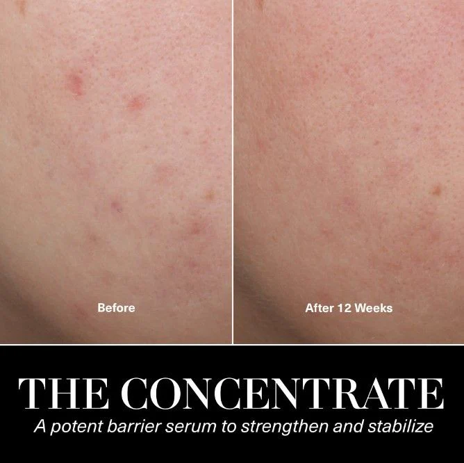 The Concentrate - Image 5