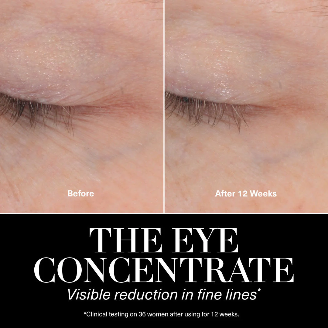 The Eye Concentrate - Image 4