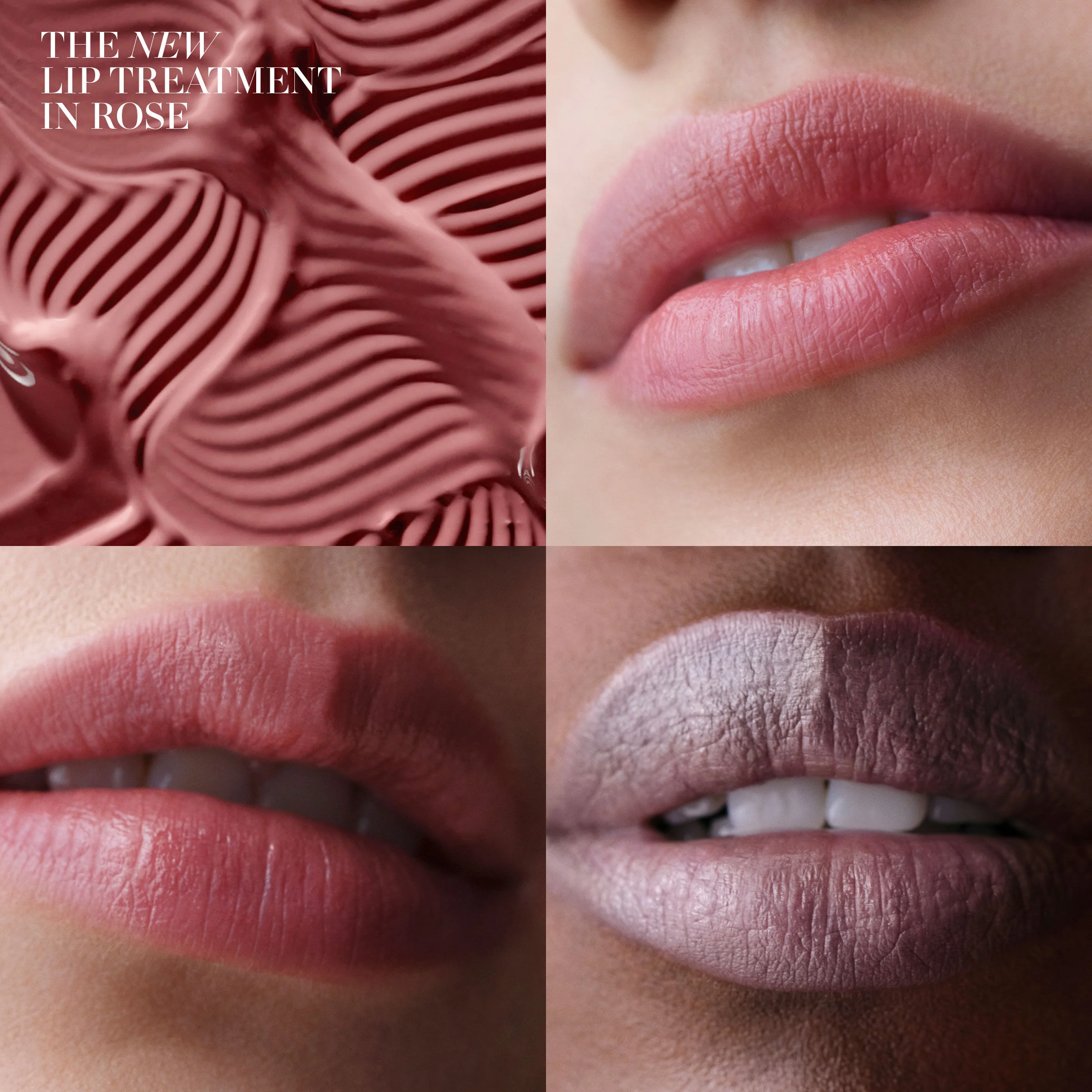 The Lip Treatment - Image 17