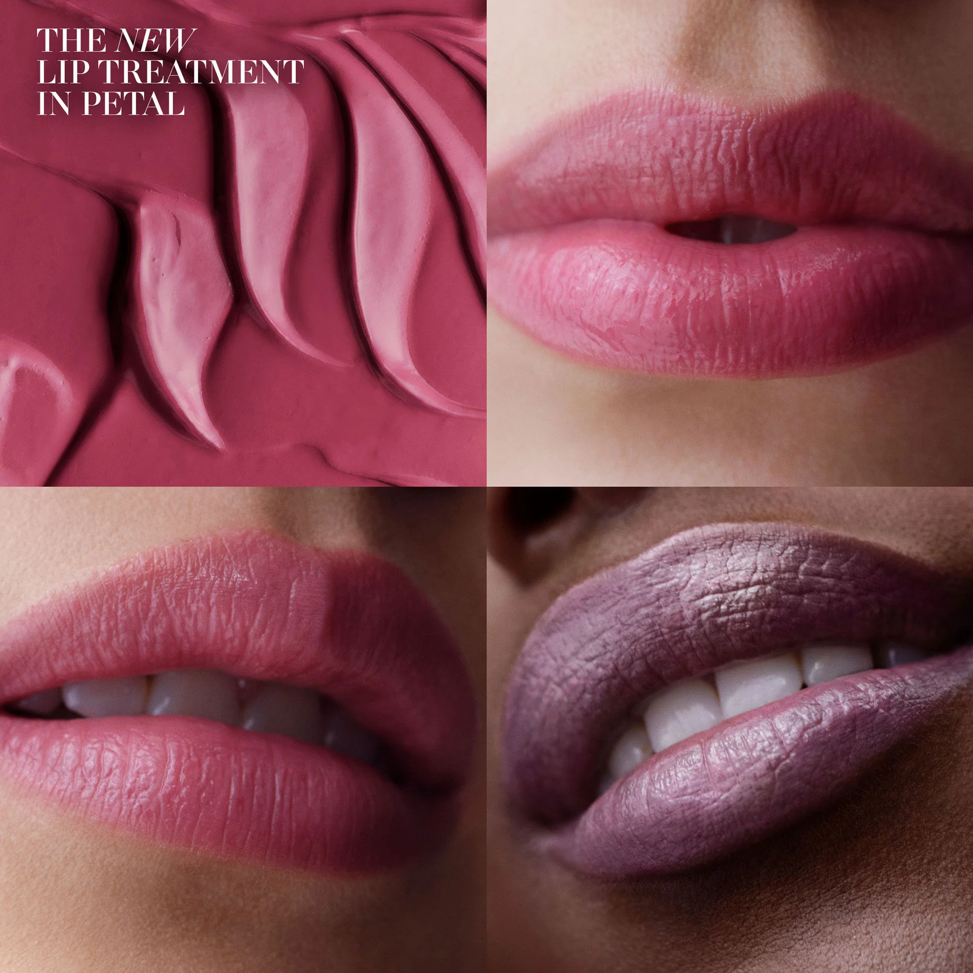 The Lip Treatment - Image 24