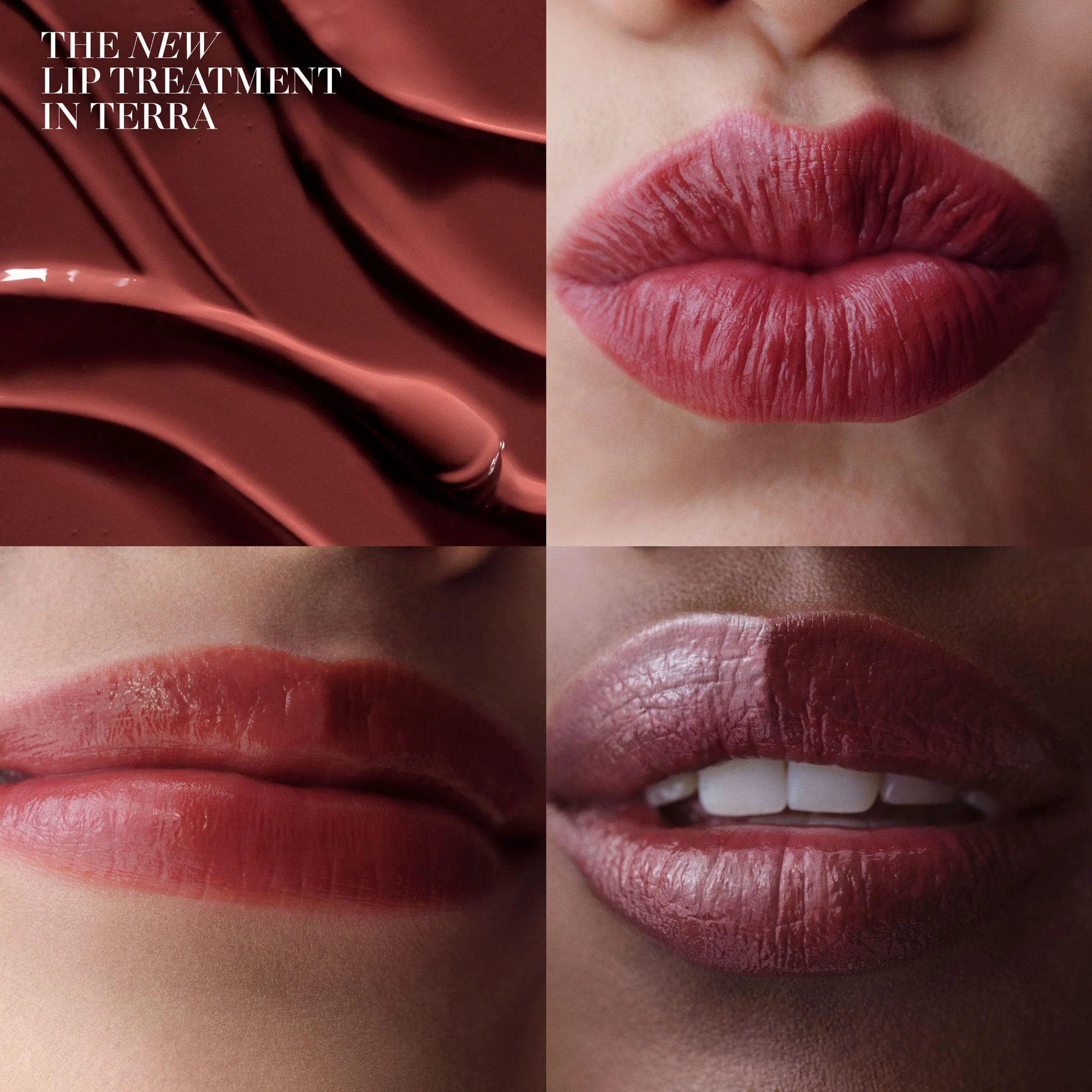 The Lip Treatment - Image 27