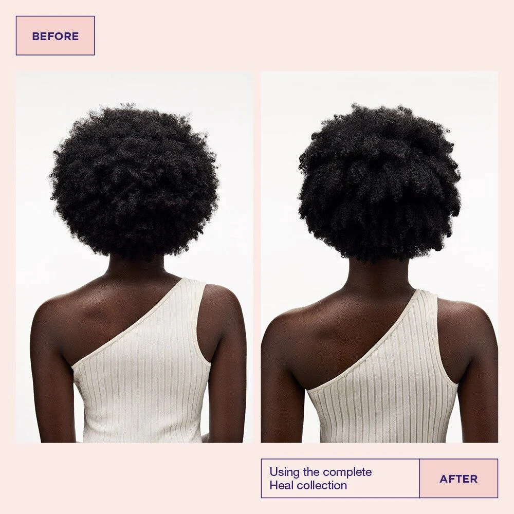 Head & Hair Heal Shampoo - Image 5
