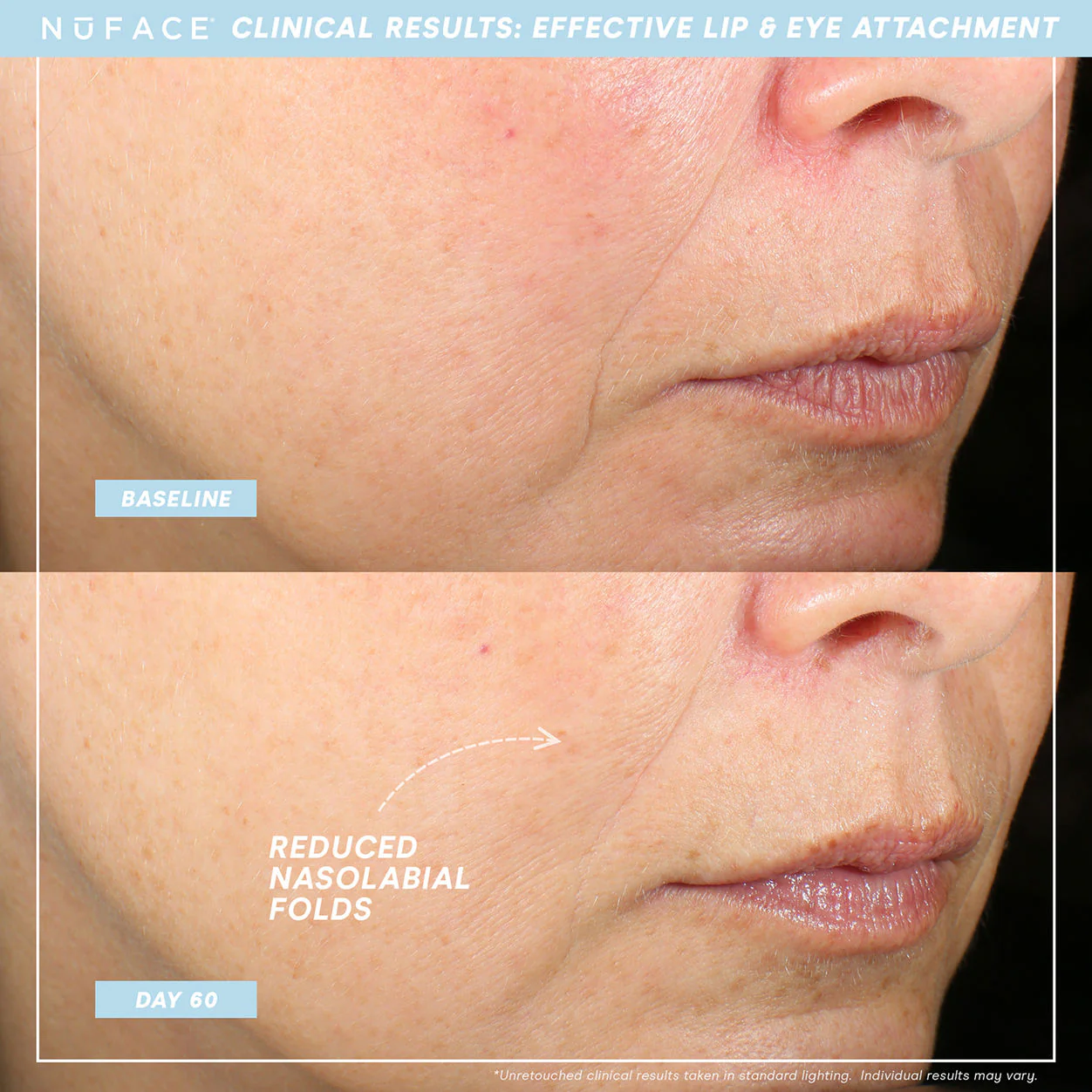 Trinity+ and Effective Lip and Eye Attachment - Image 4