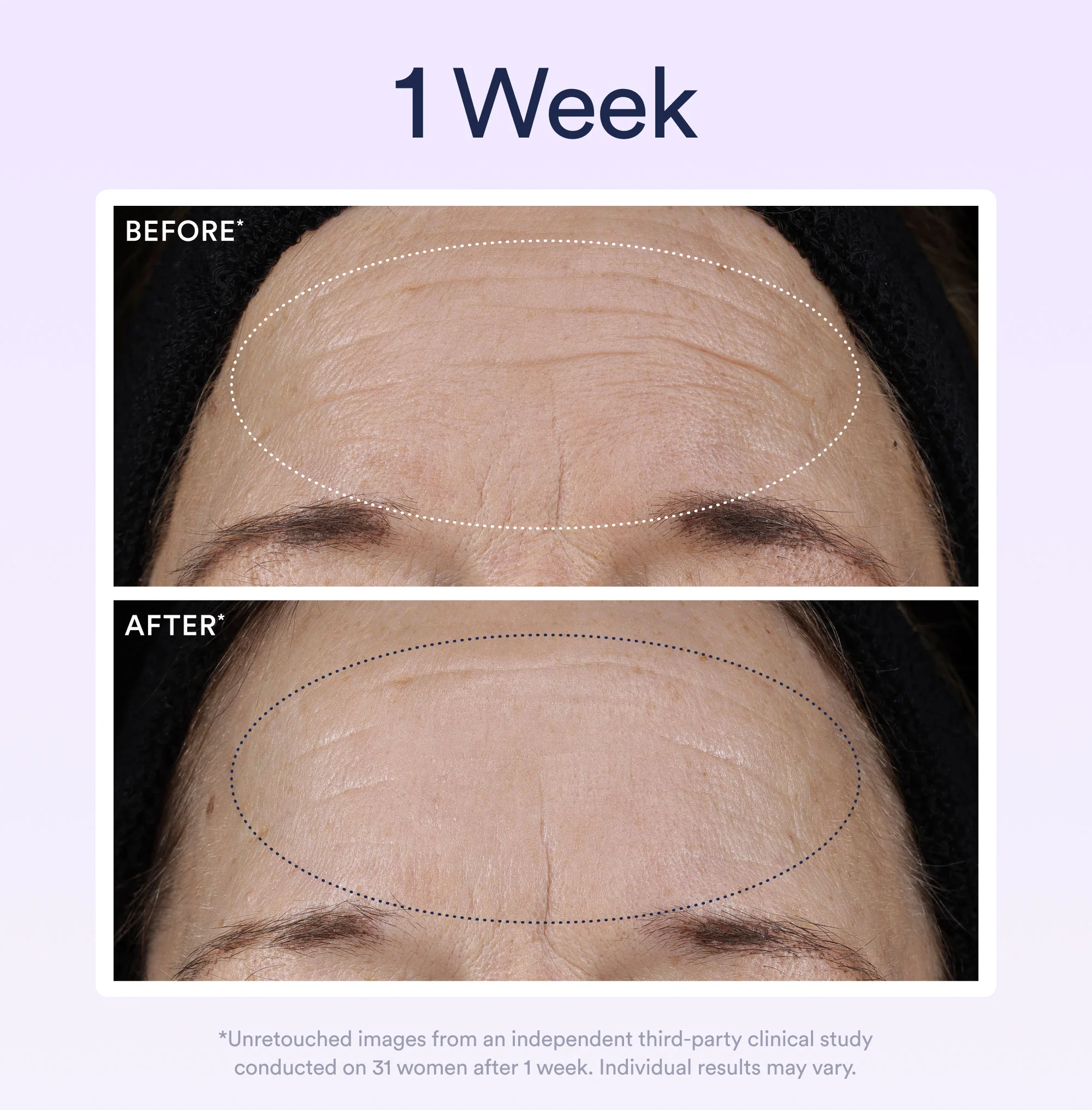 Dream Night Serum with Bio-Retinol - Image 10