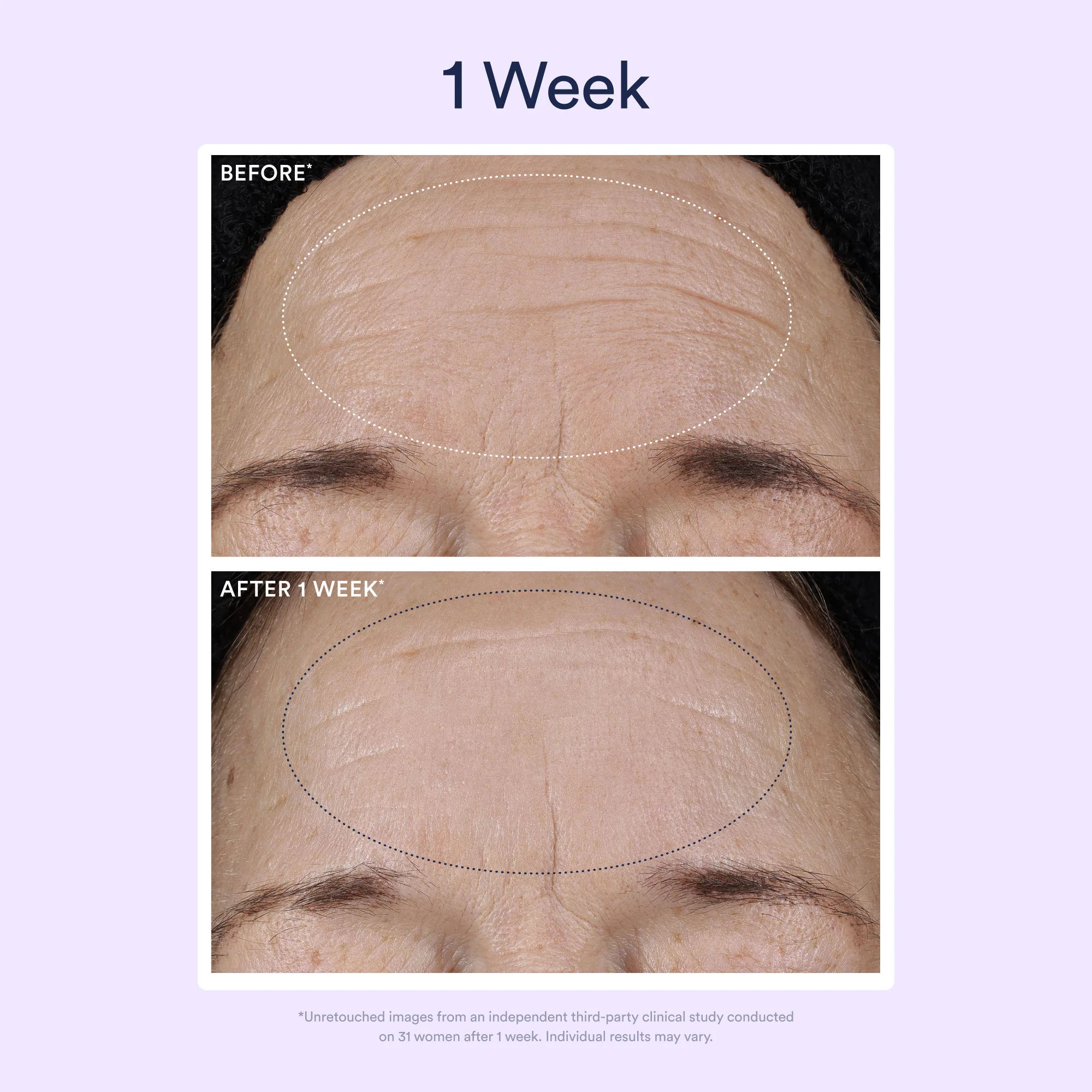 Dream Night Serum with Bio-Retinol - Image 5