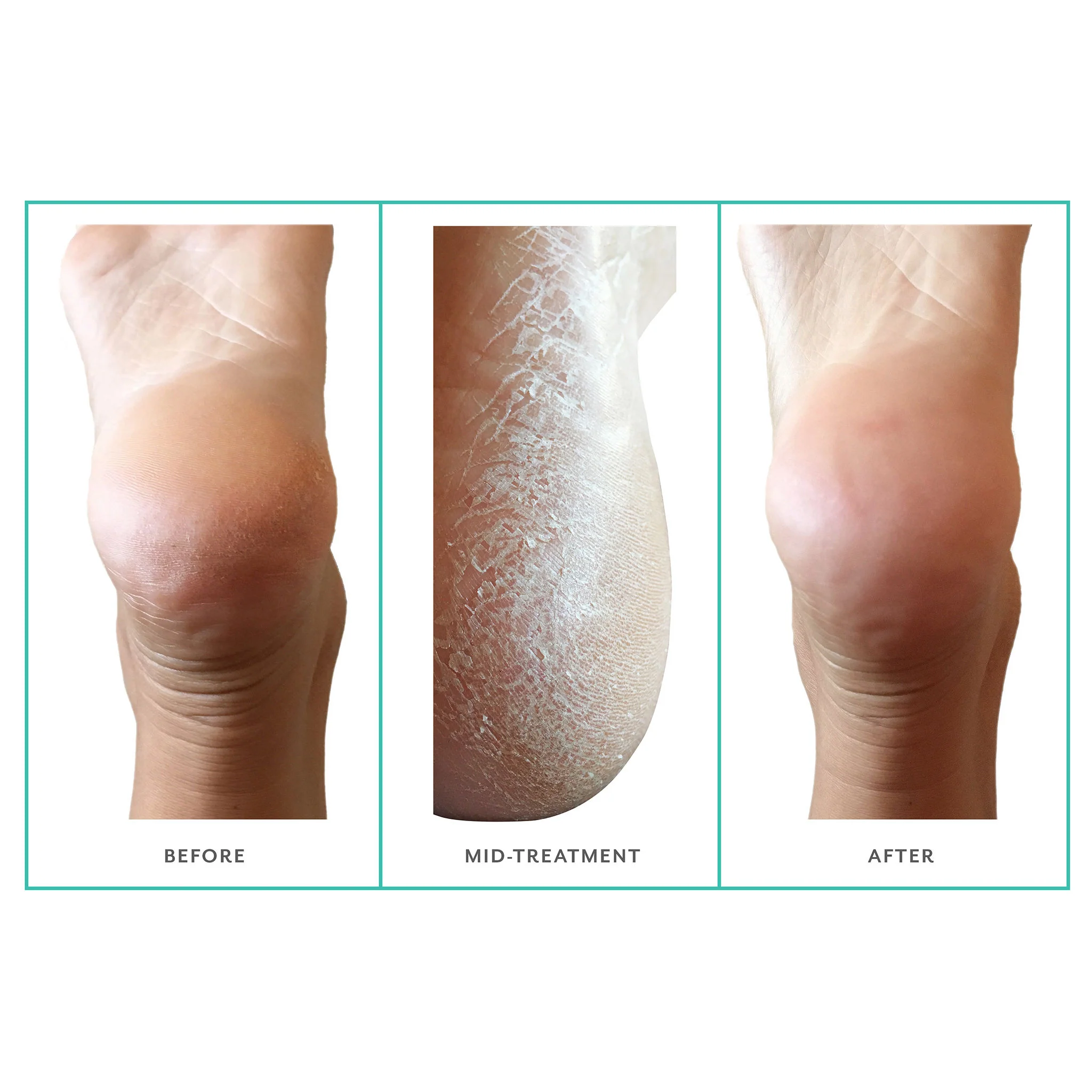 PoshPeel Pedi Cure - Image 4