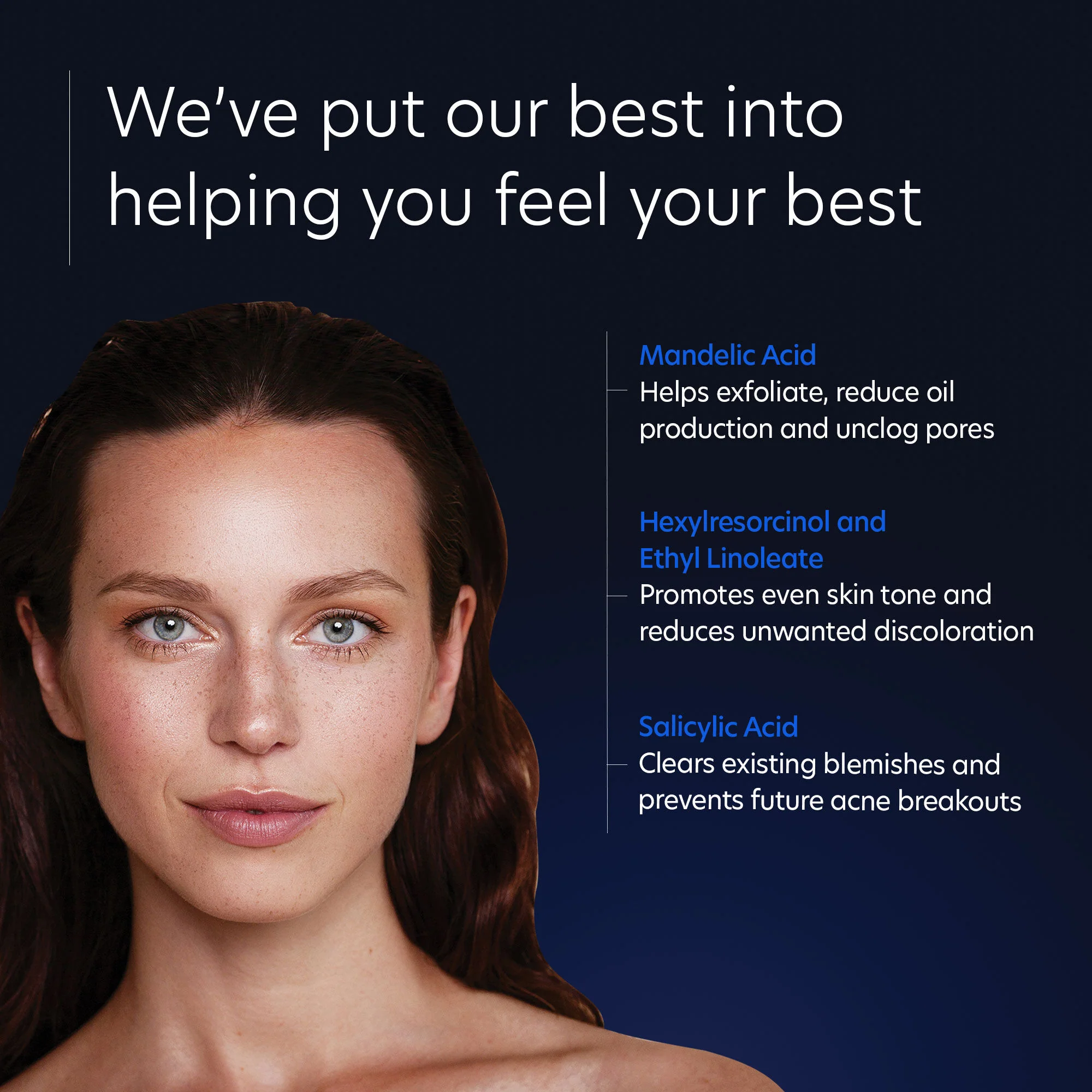 Acne Gel With OmniSome - Image 5