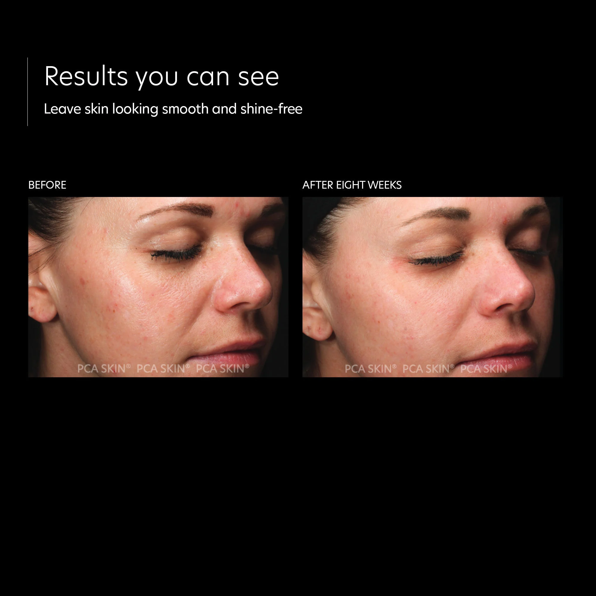 HydraMatte - Image 3
