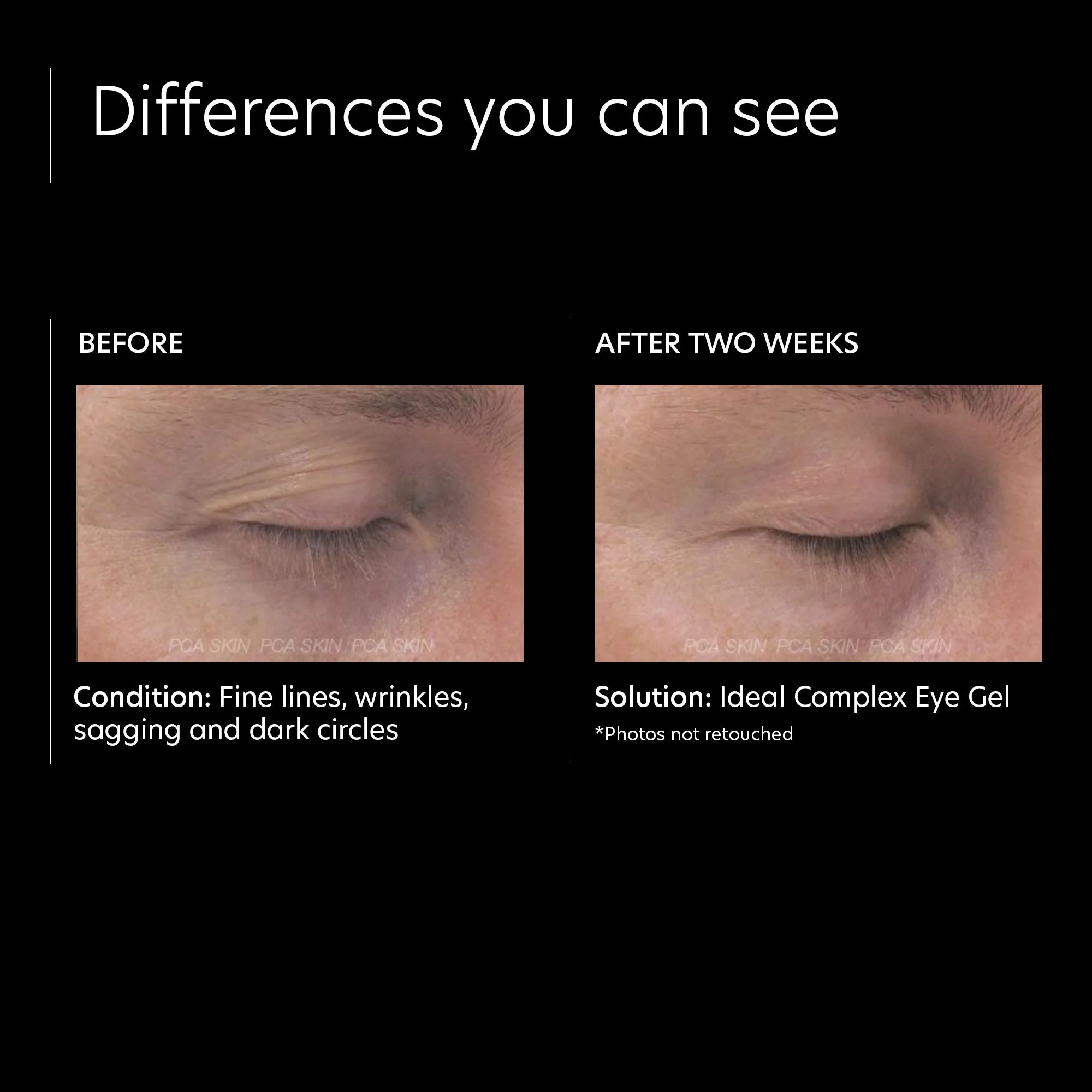 Ideal Complex Revitalizing Eye Gel - Image 3