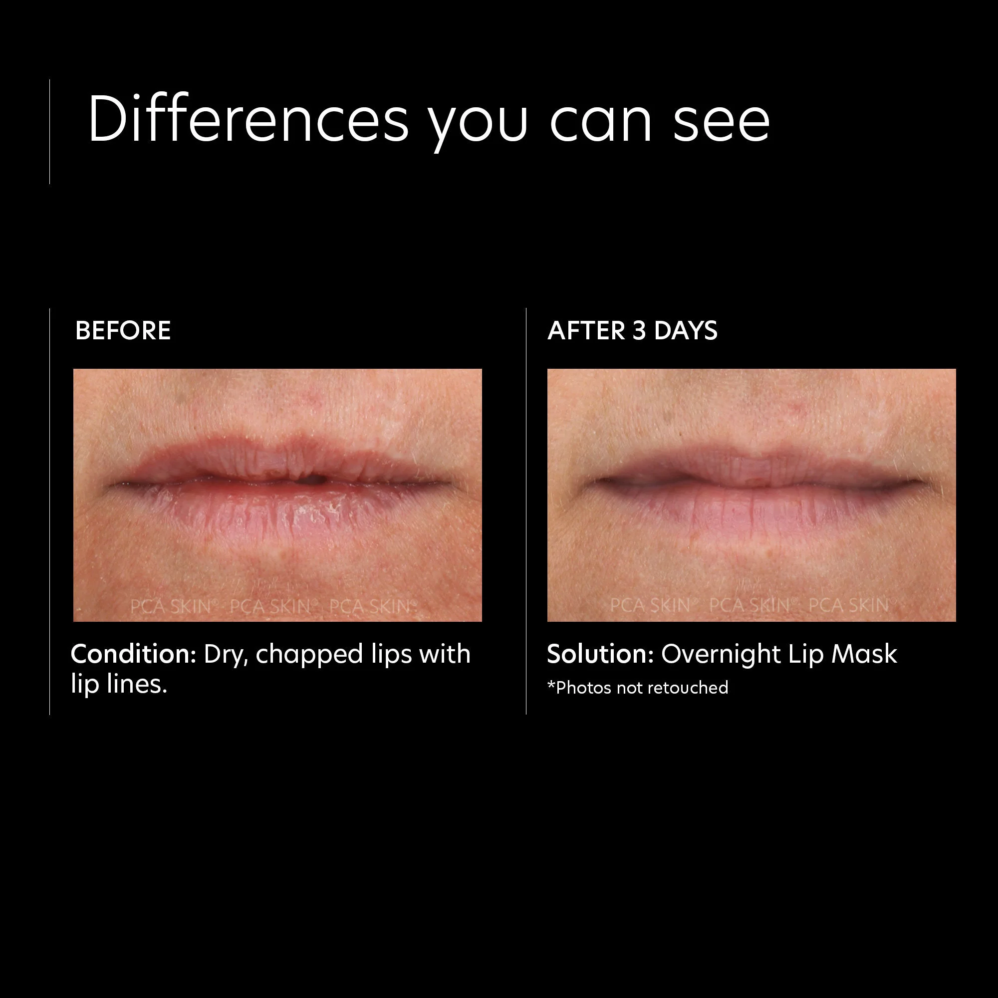Overnight Lip Mask - Image 3