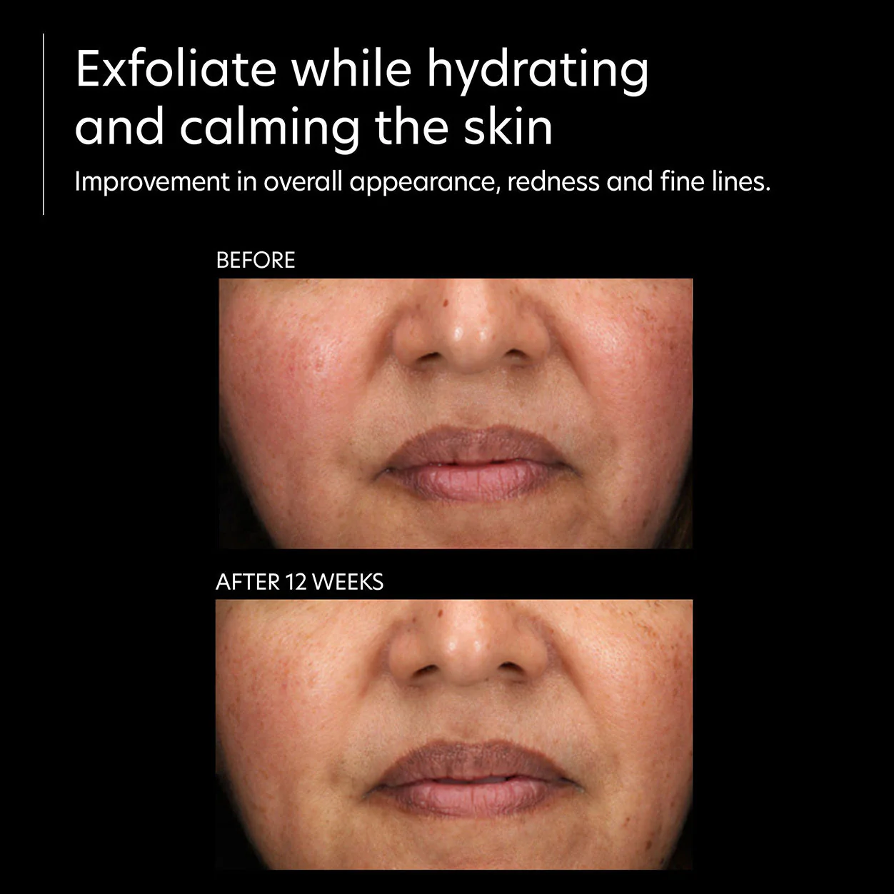 Resurfacing Serum - Image 3