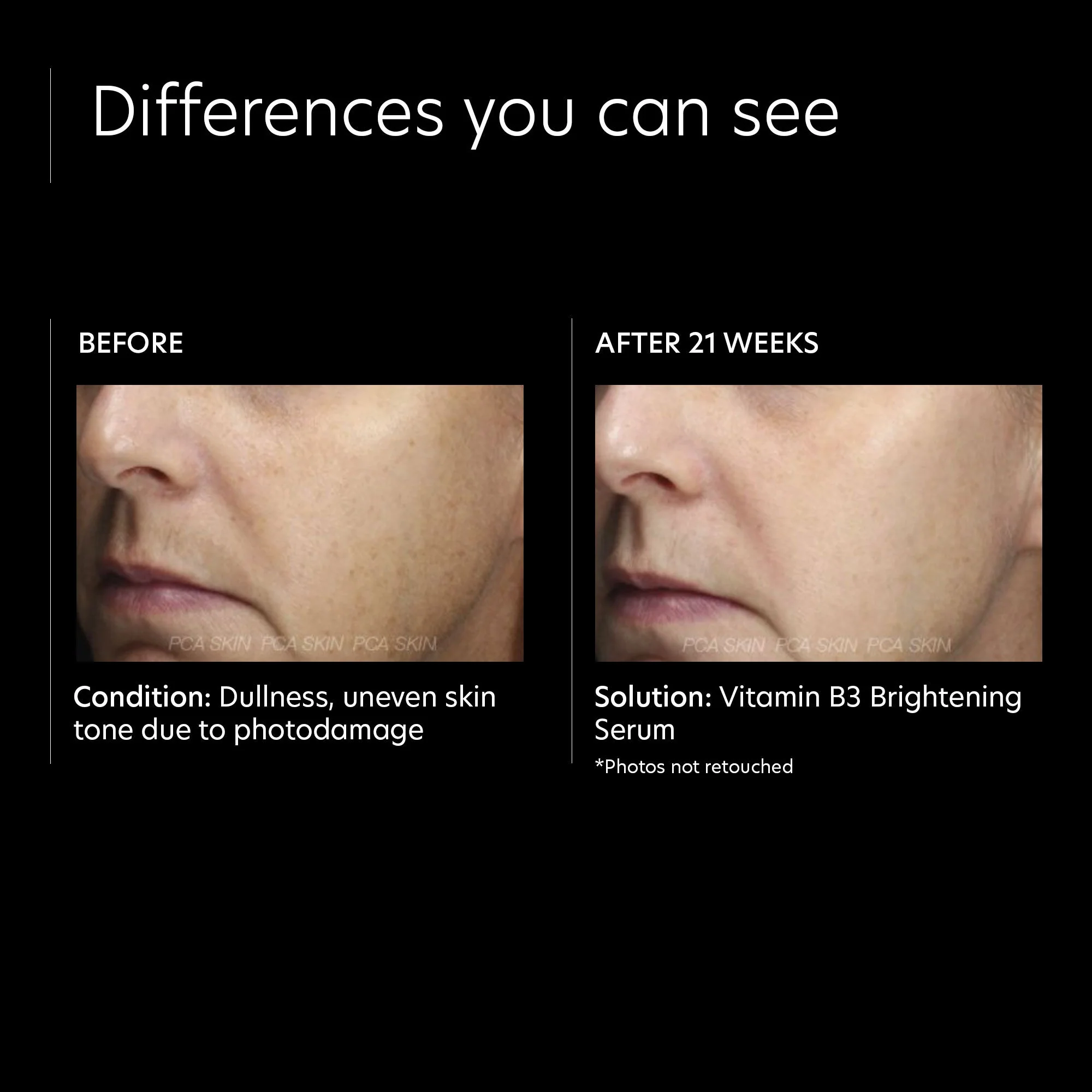 Vitamin B3 Brightening Serum - Image 3
