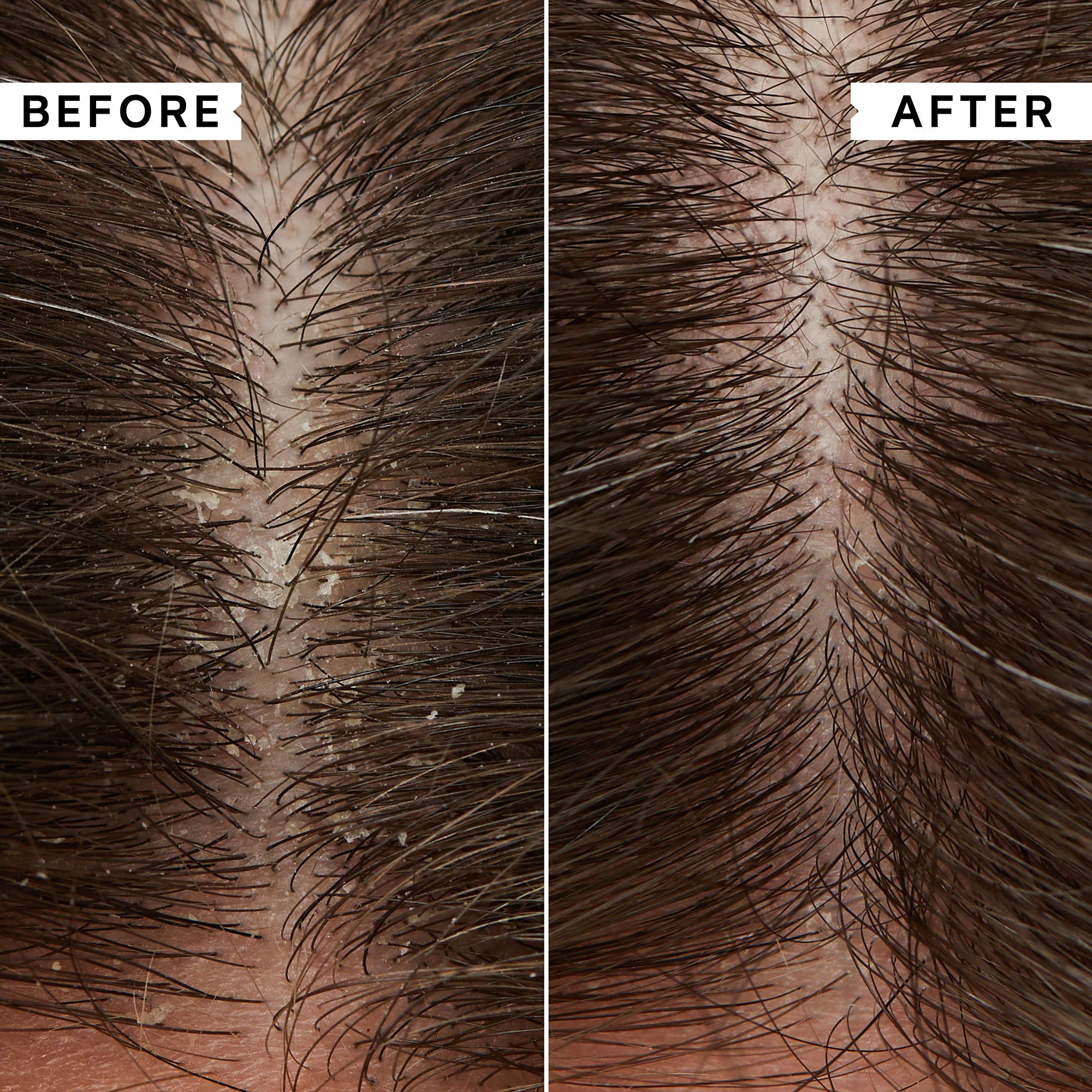 Flaky Scalp Cleansing Shampoo - Image 2