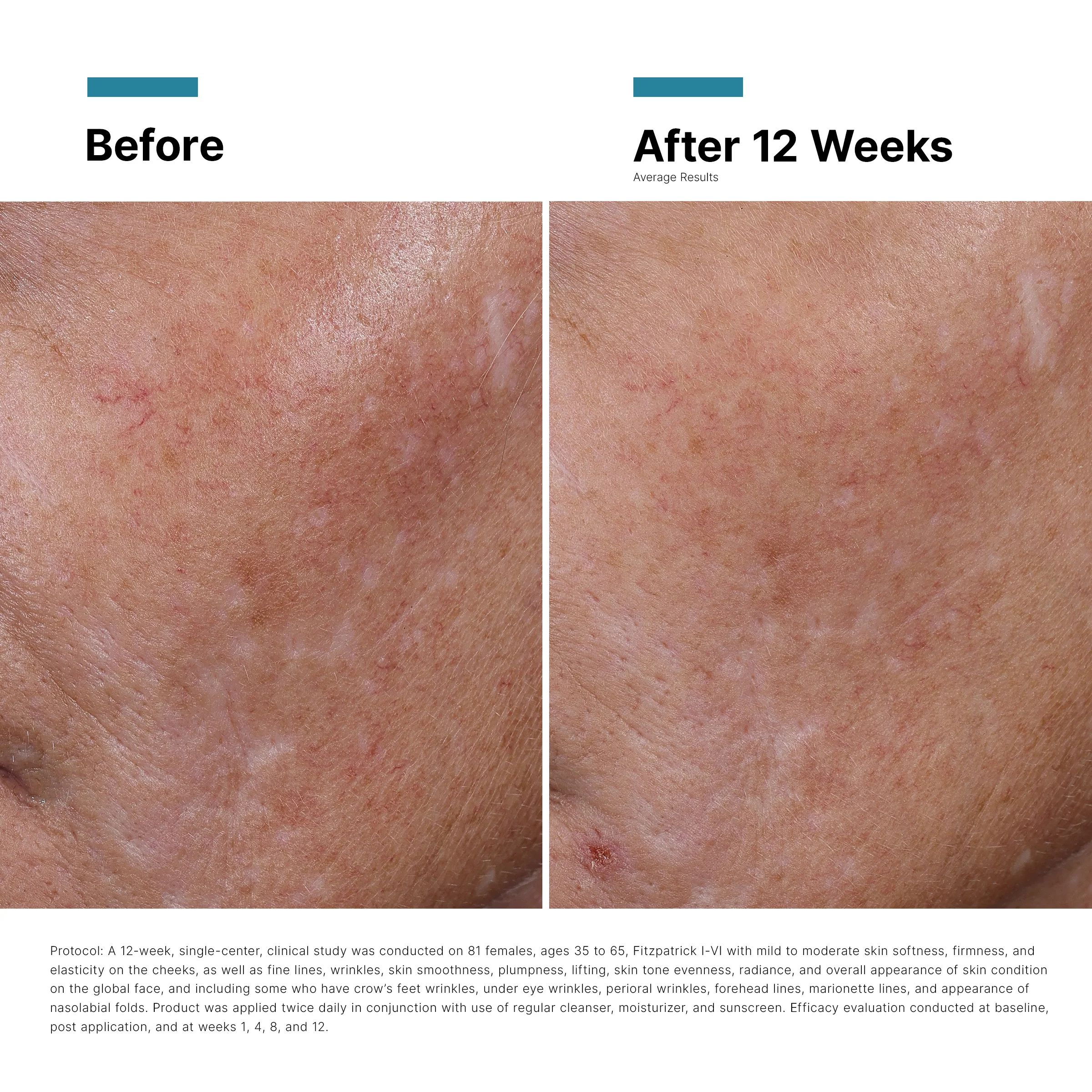 Post Injection Duo - Image 7