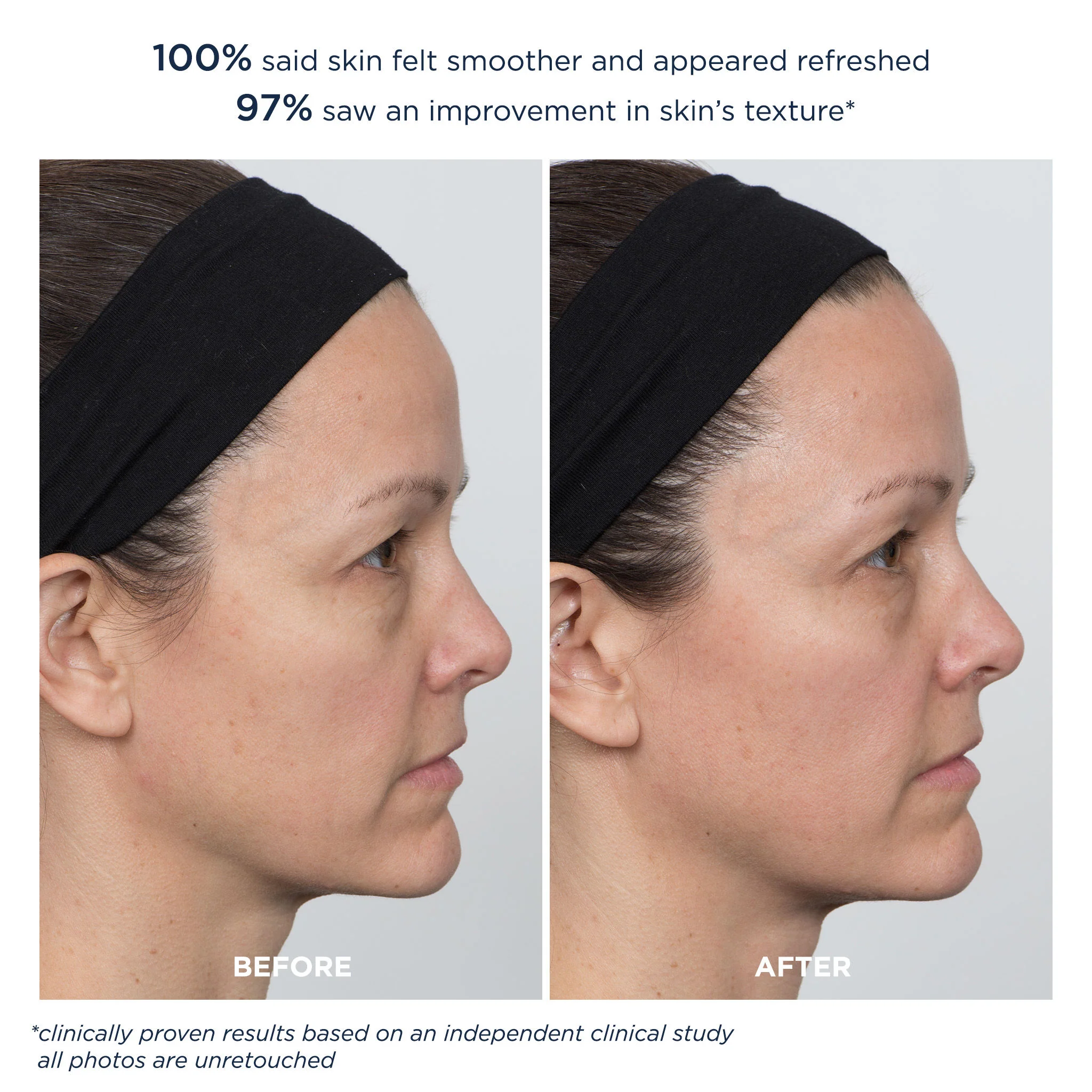 PowerGlow Peel Extra Strength - Image 5