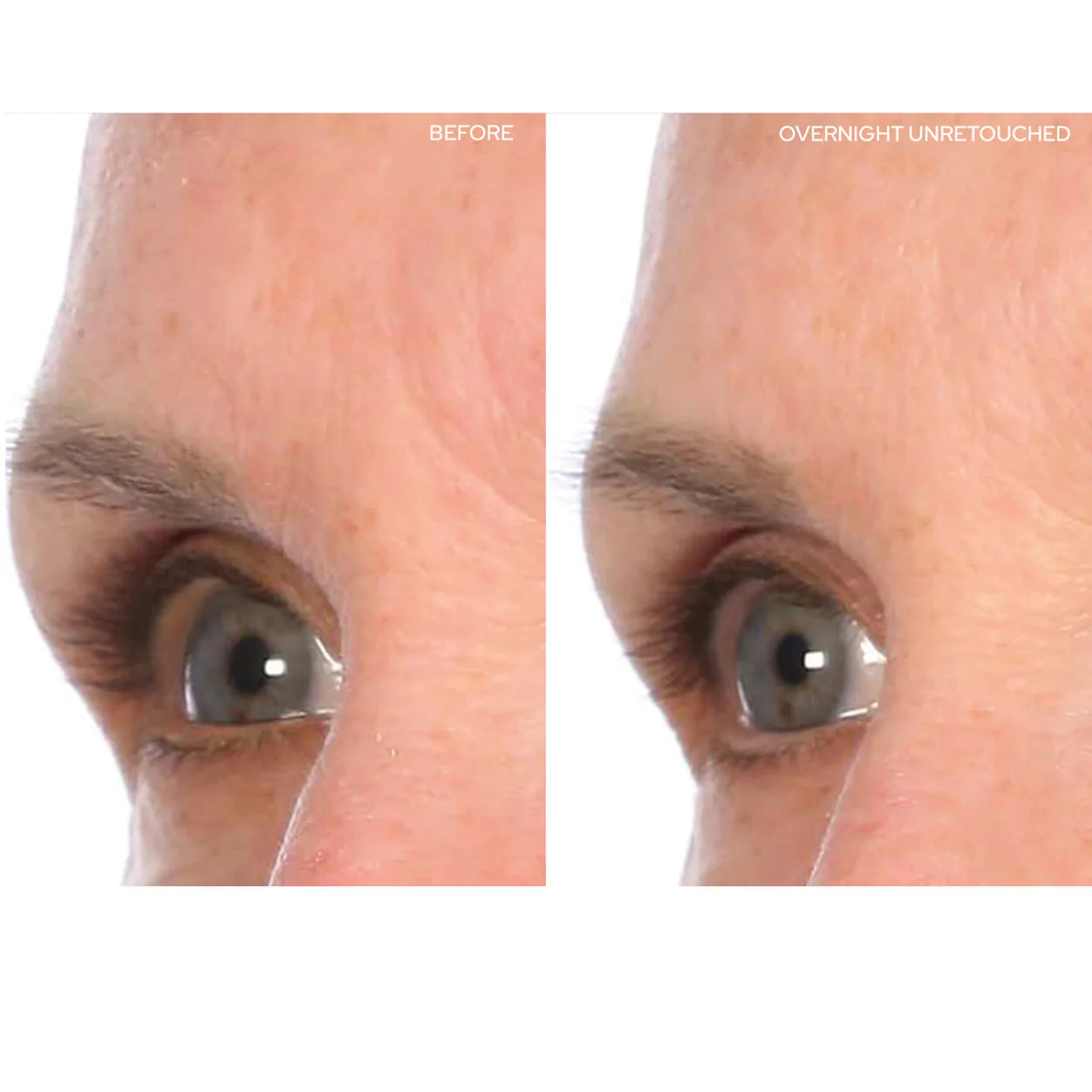 BrowLift - Image 2