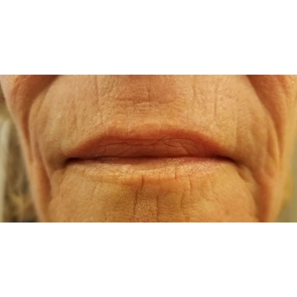 Super Liplift 2-Pack - Image 2