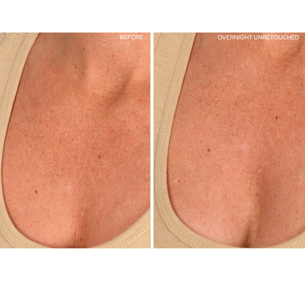 ChestLift - Image 2