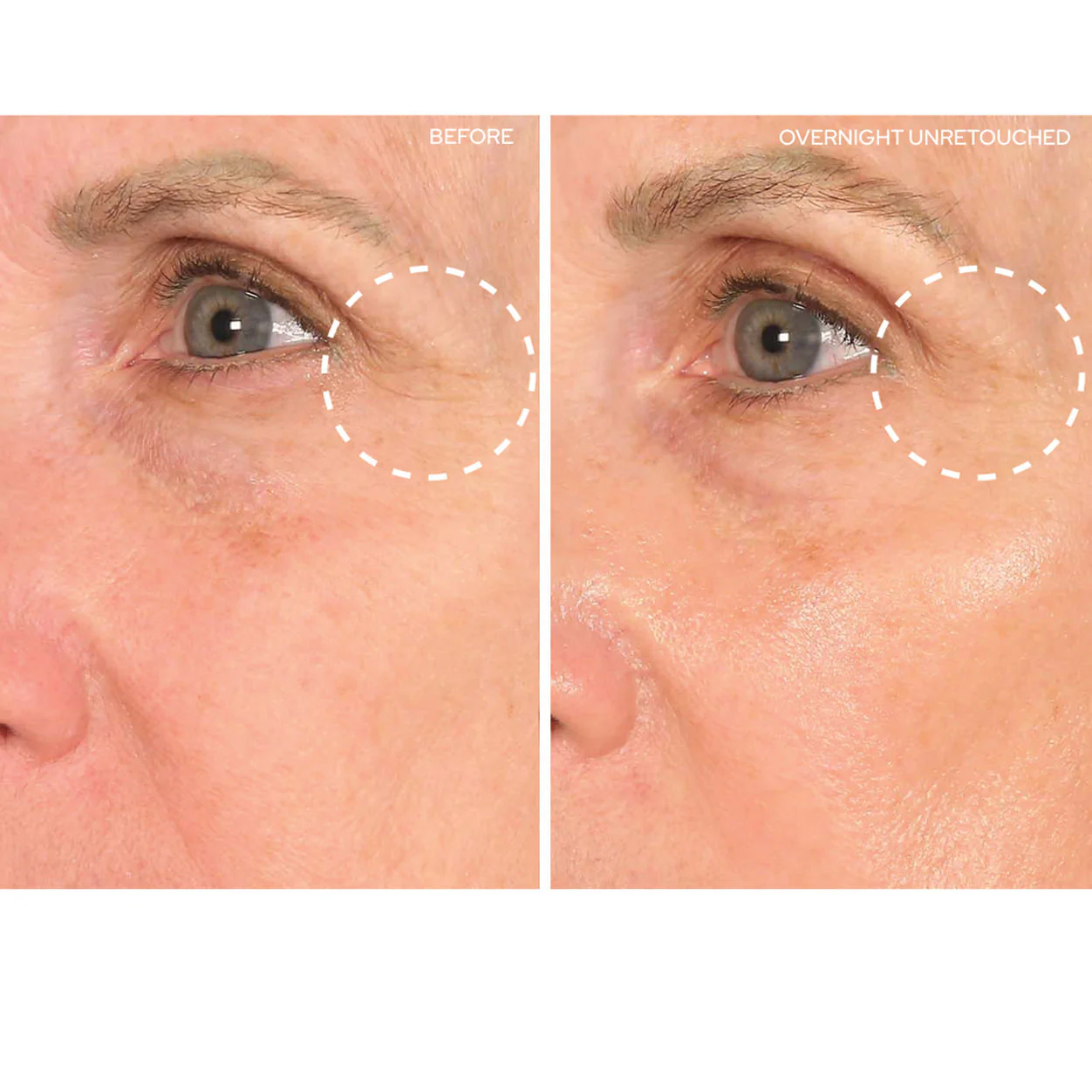 Super EyeLift - Image 2