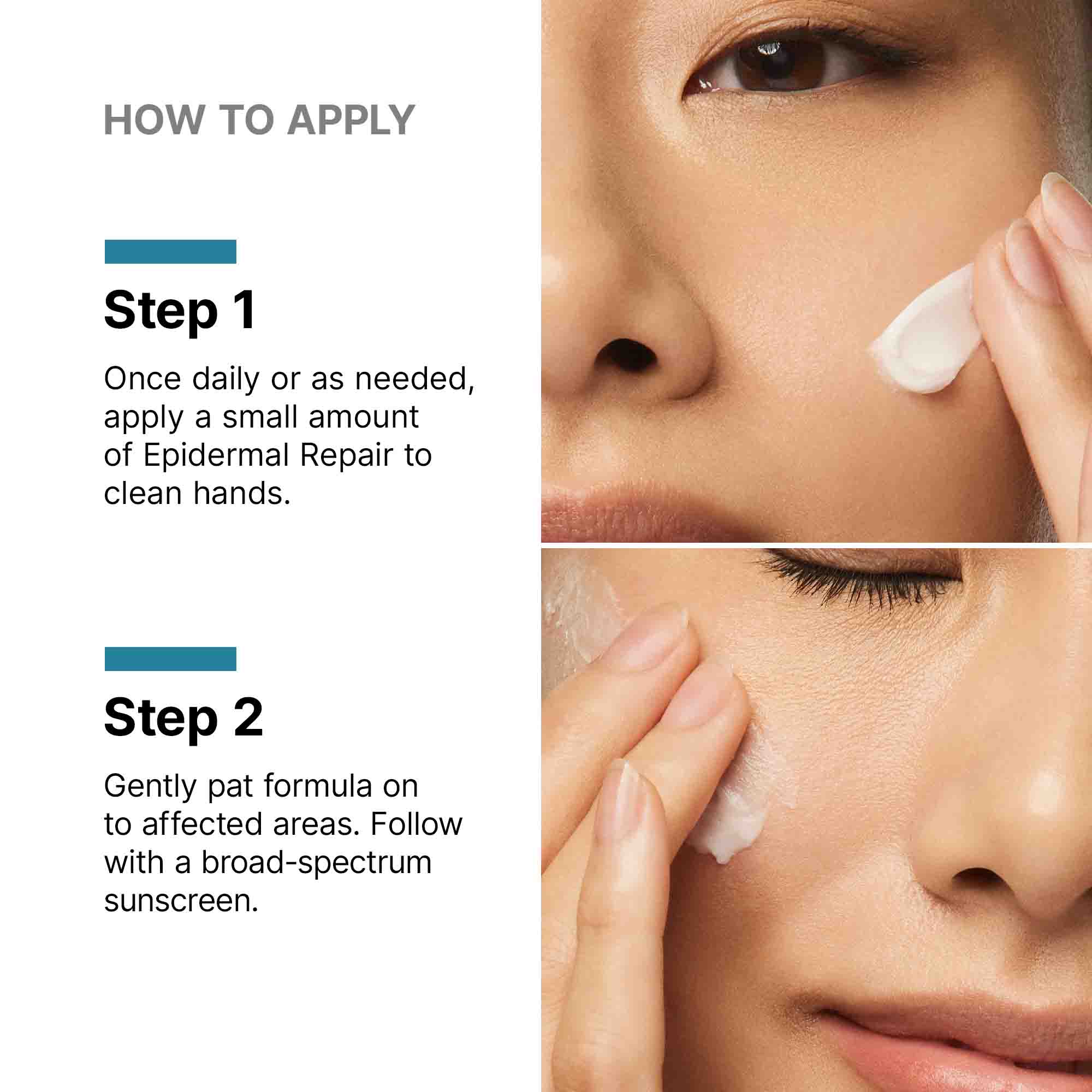 Epidermal Repair - Image 7