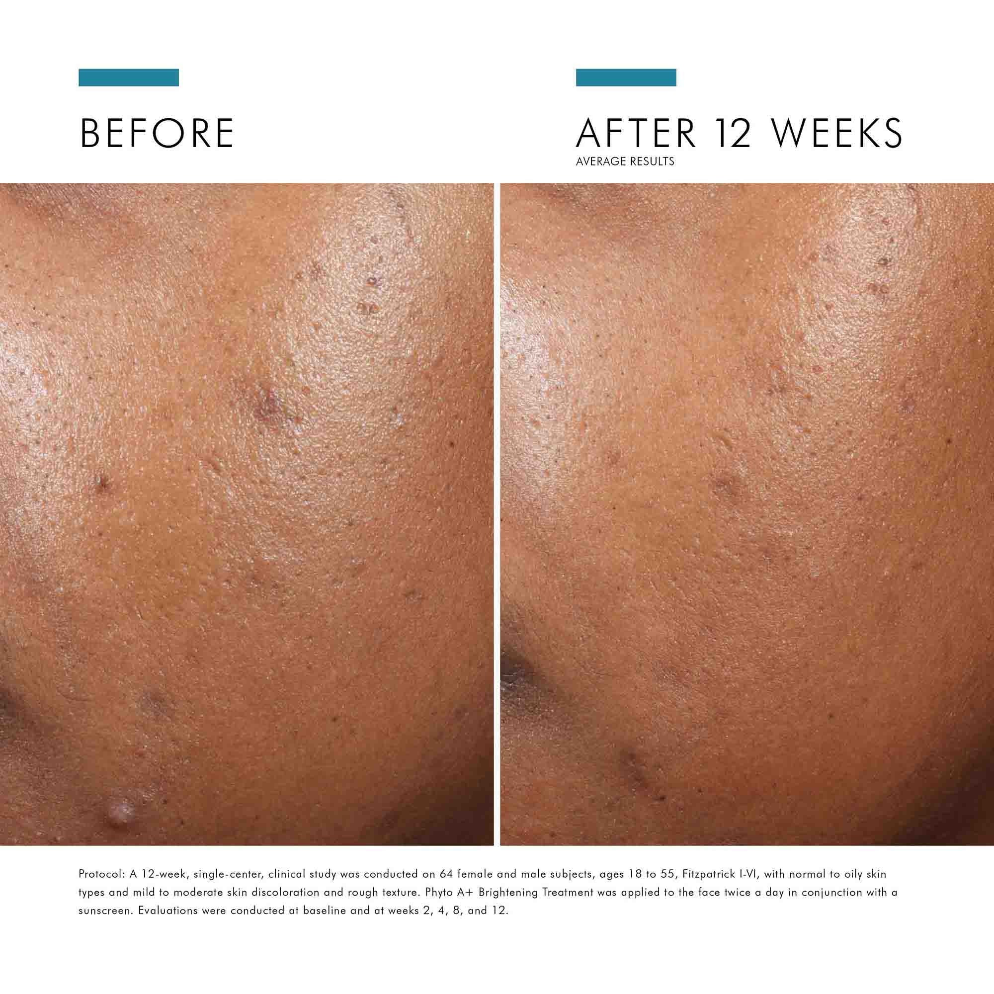 Phyto A+ Brightening Treatment - Image 3