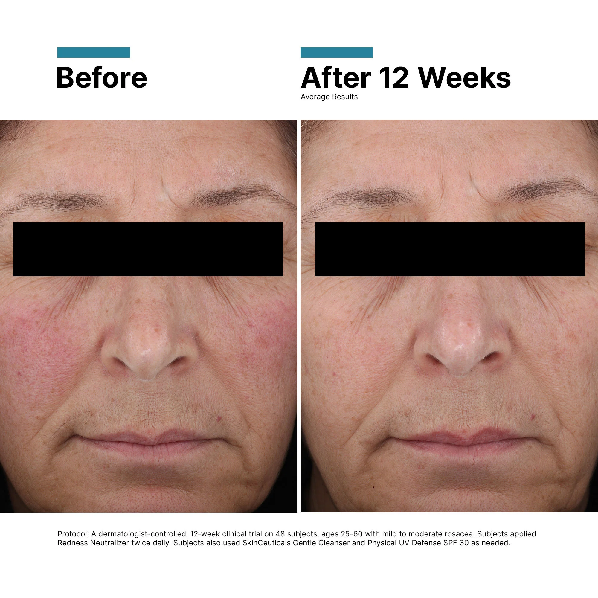 Redness Neutralizer - Image 3