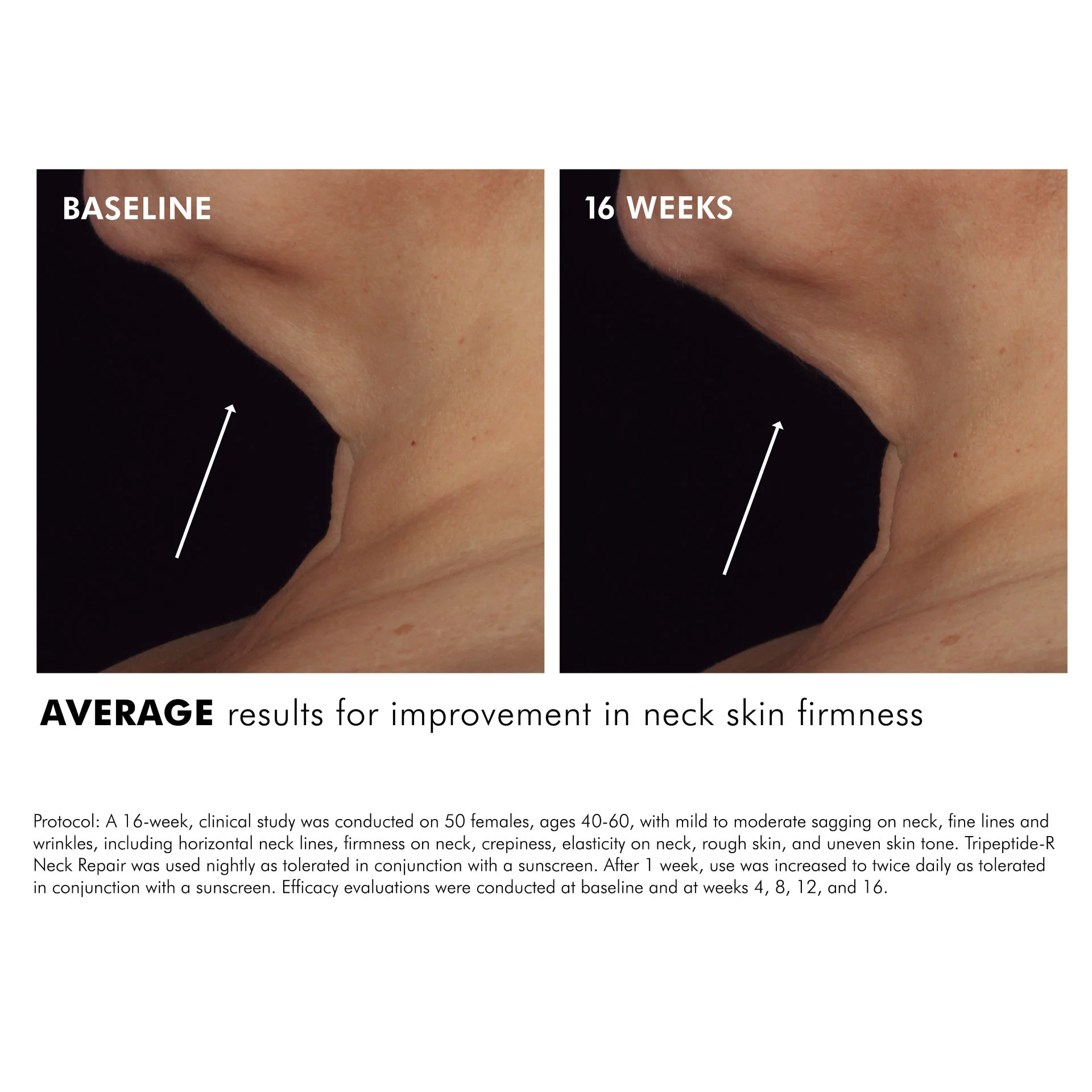 Tripeptide-R Neck Repair - Image 4