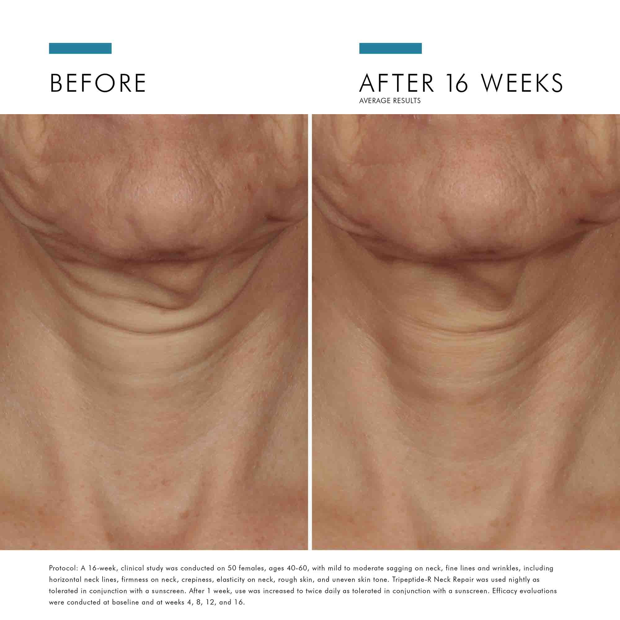 Tripeptide-R Neck Repair - Image 9