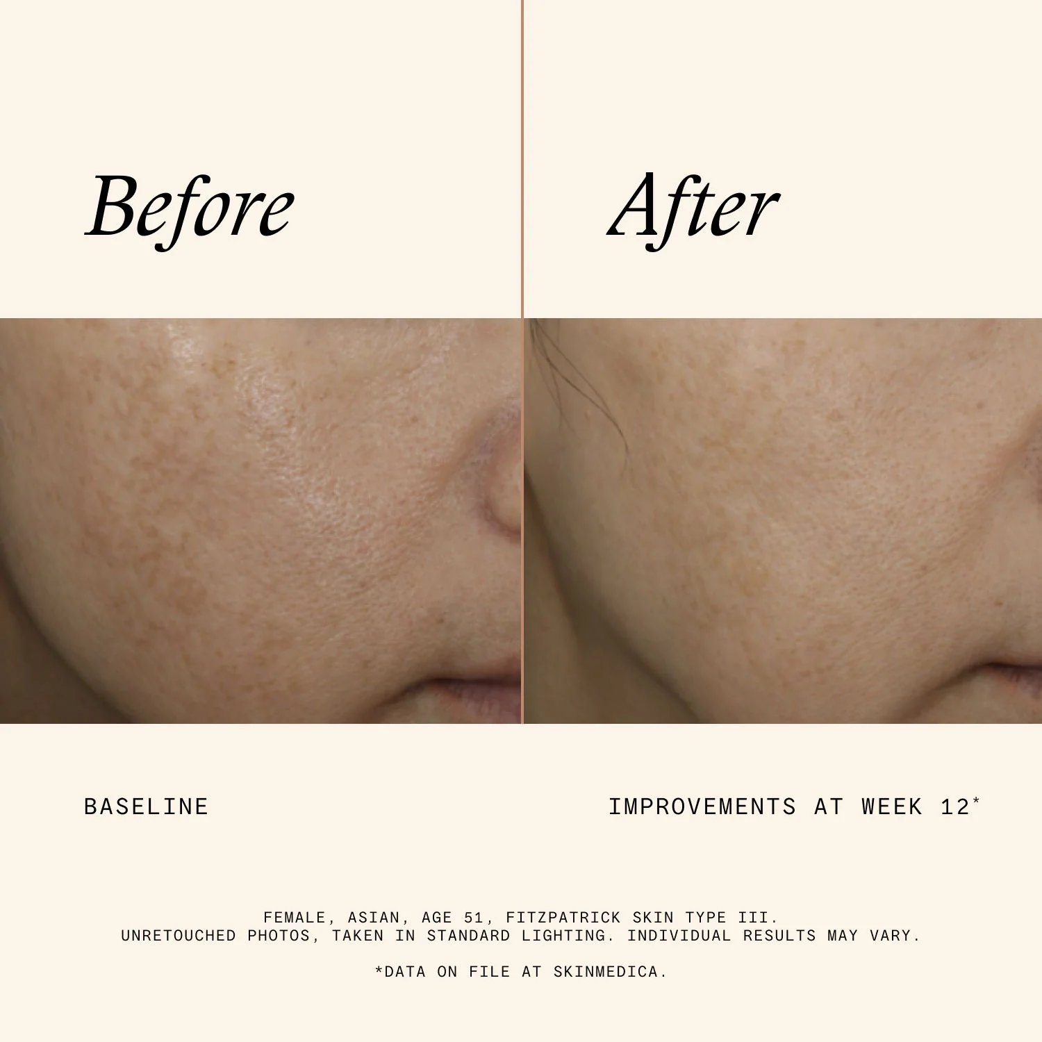 Even & Correct Advanced Brightening Treatment - Image 6