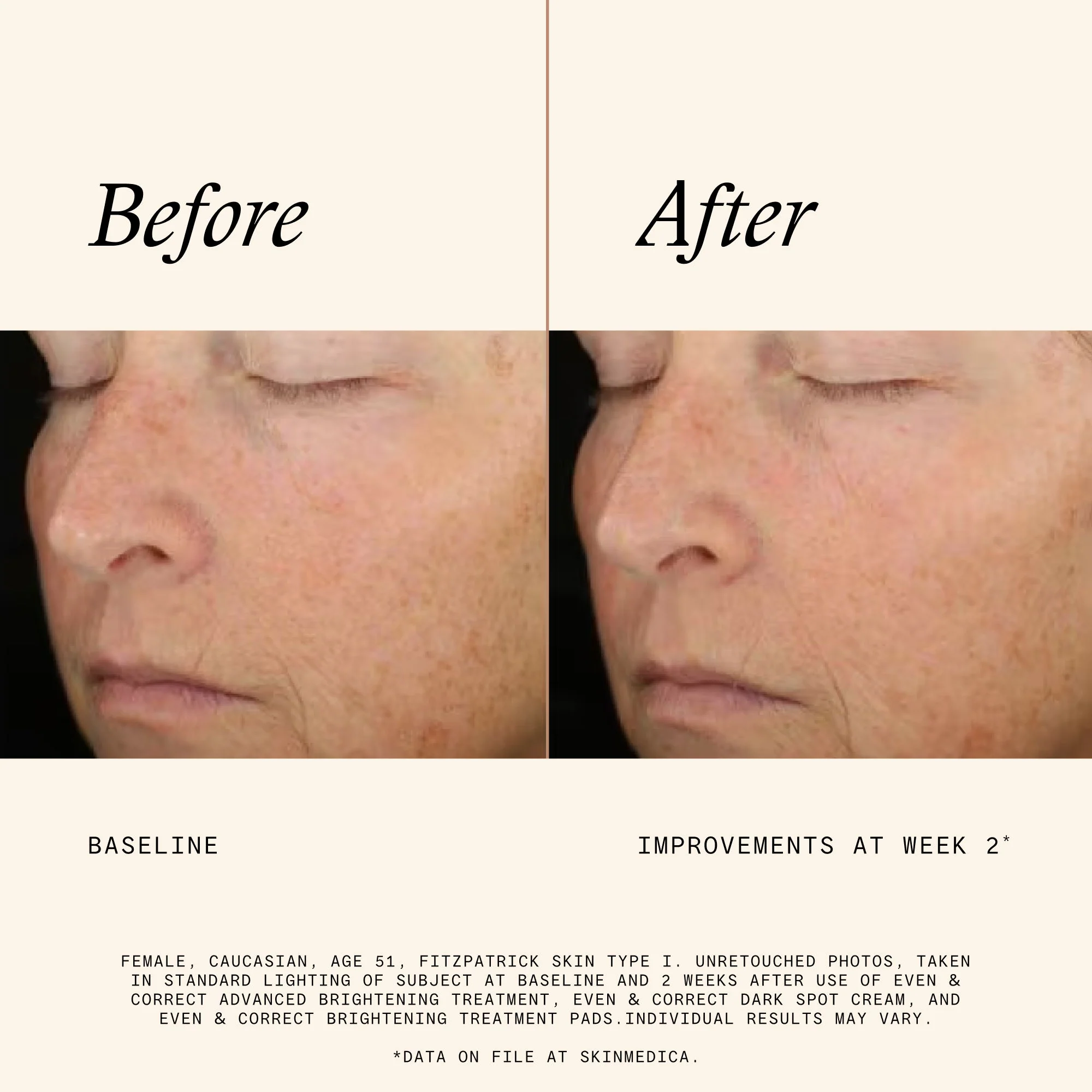 Even & Correct Brightening Treatment Pads - Image 6