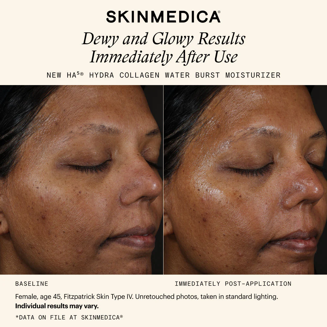 HA5 Hydra Collagen Water Burst Moisturizer - Image 10