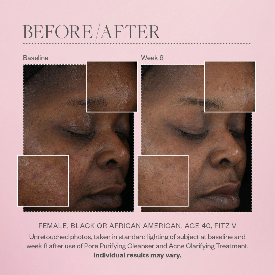 Pore Purifying Gel Cleanser - Image 3