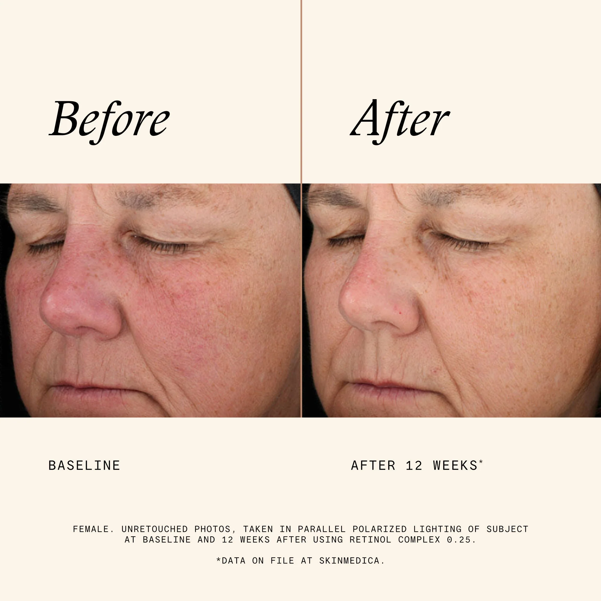 Retinol Complex 0.25 - Image 6