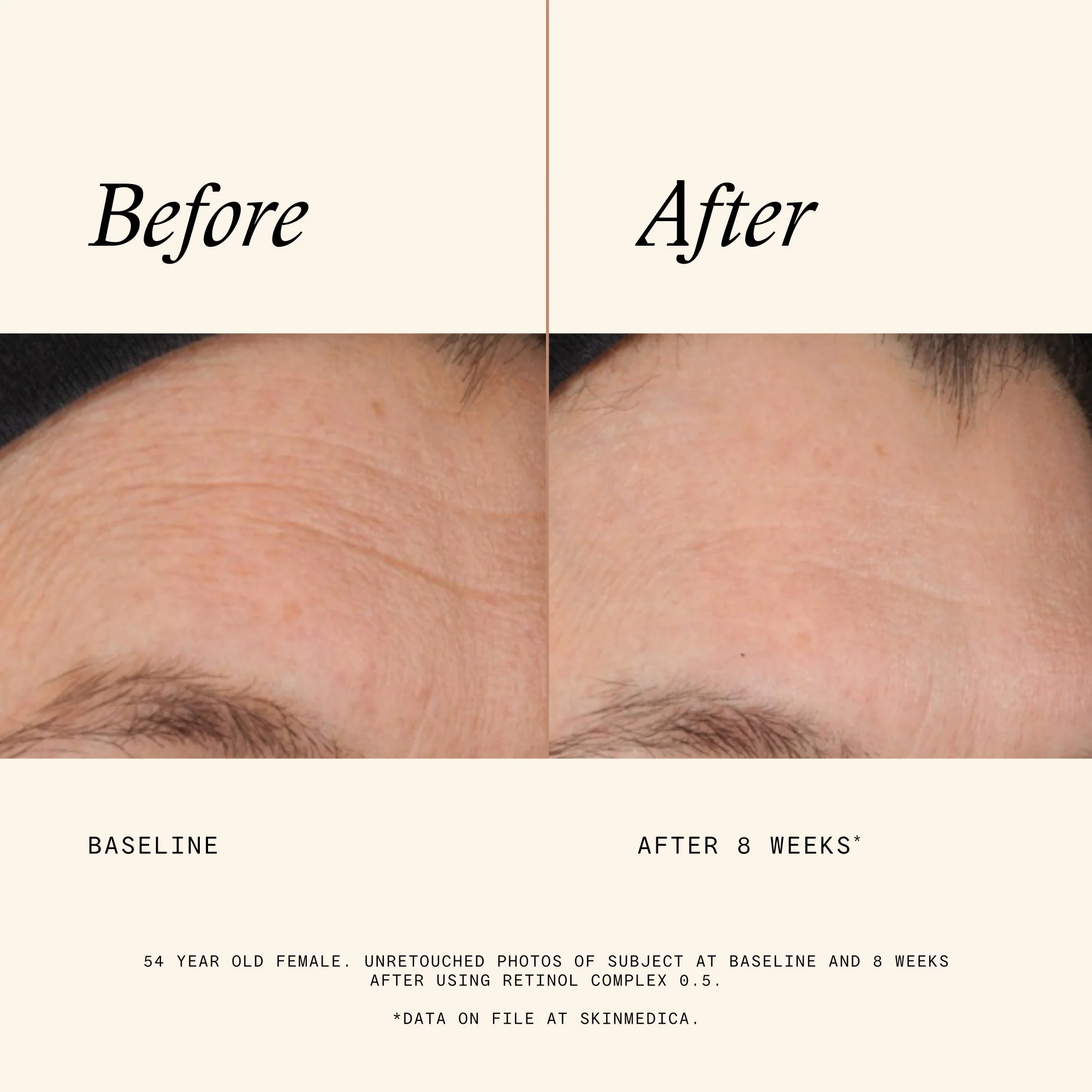 Retinol Complex 0.5 - Image 6