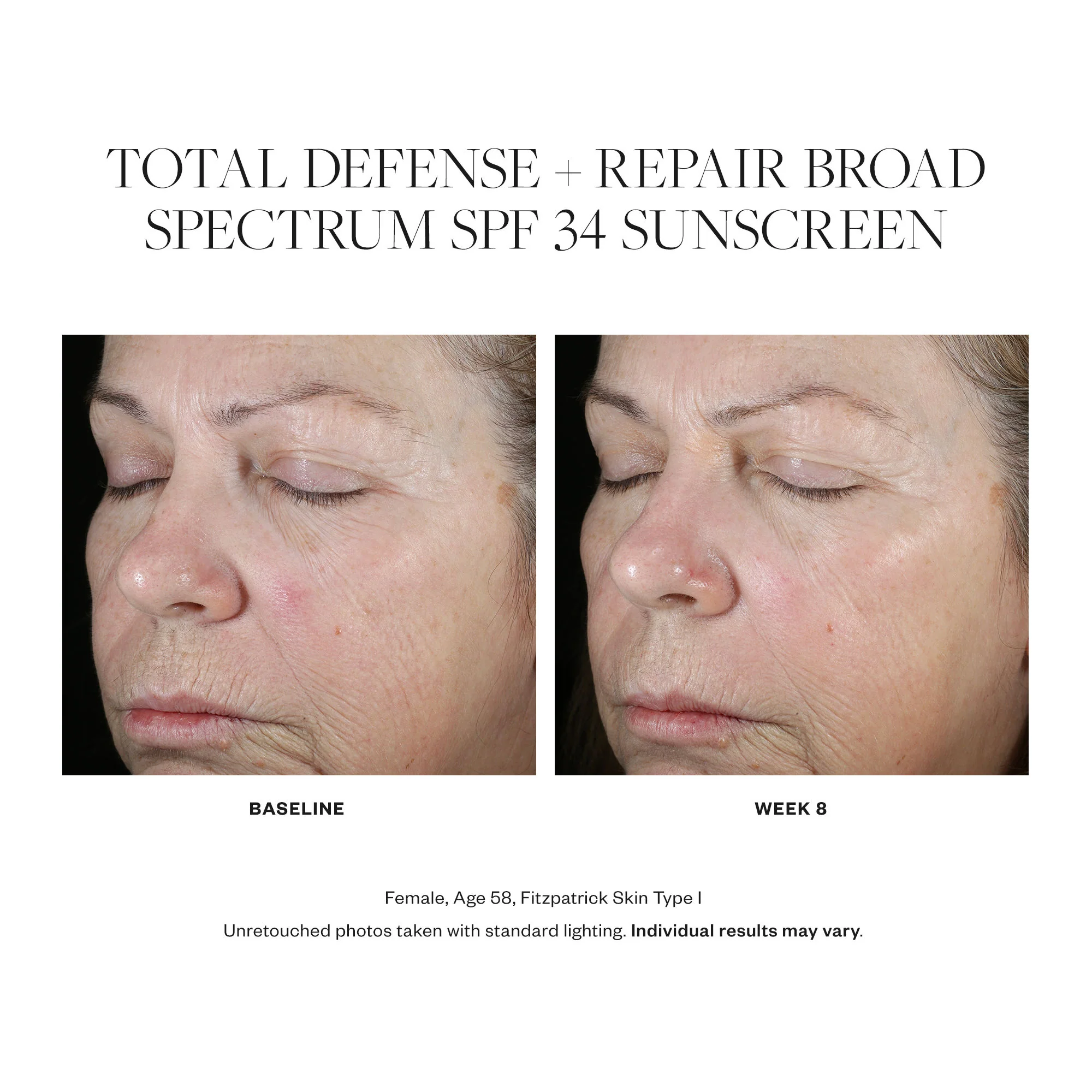 Total Defense + Repair Broad Spectrum SPF 34 Sunscreen - Image 4