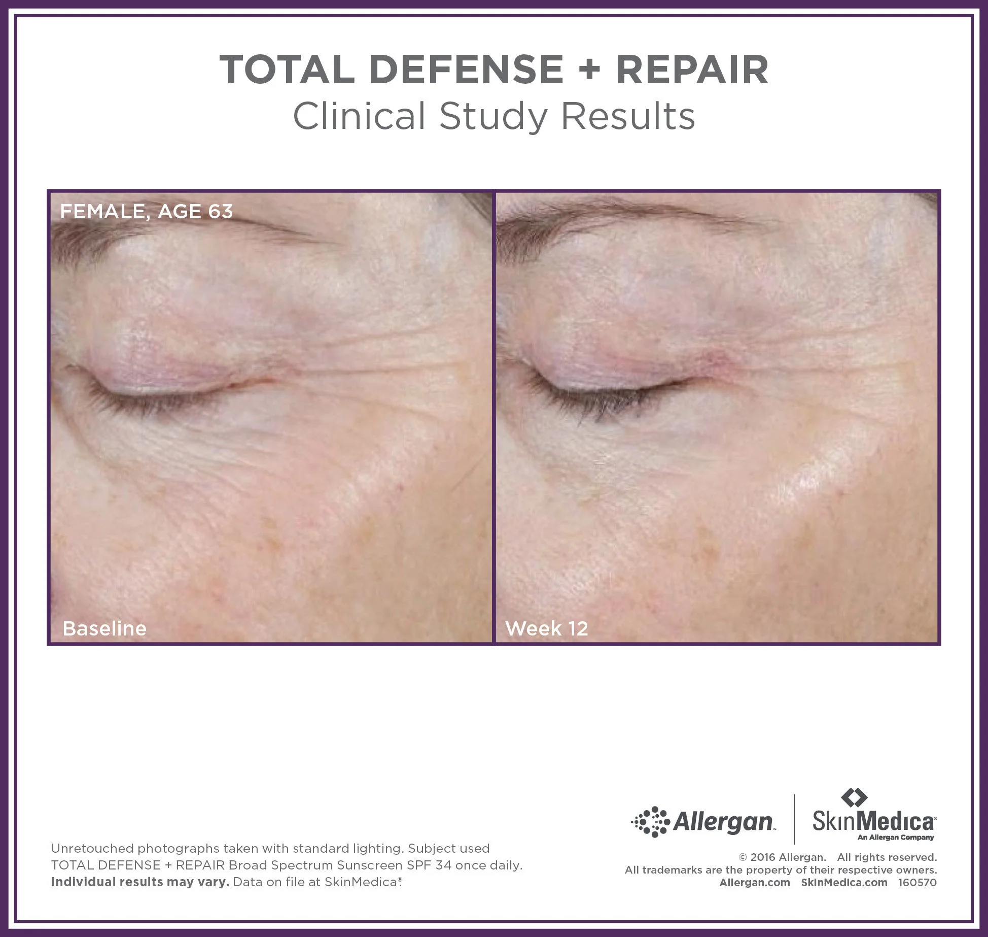 Total Defense + Repair Broad Spectrum SPF 34 Sunscreen - Image 5