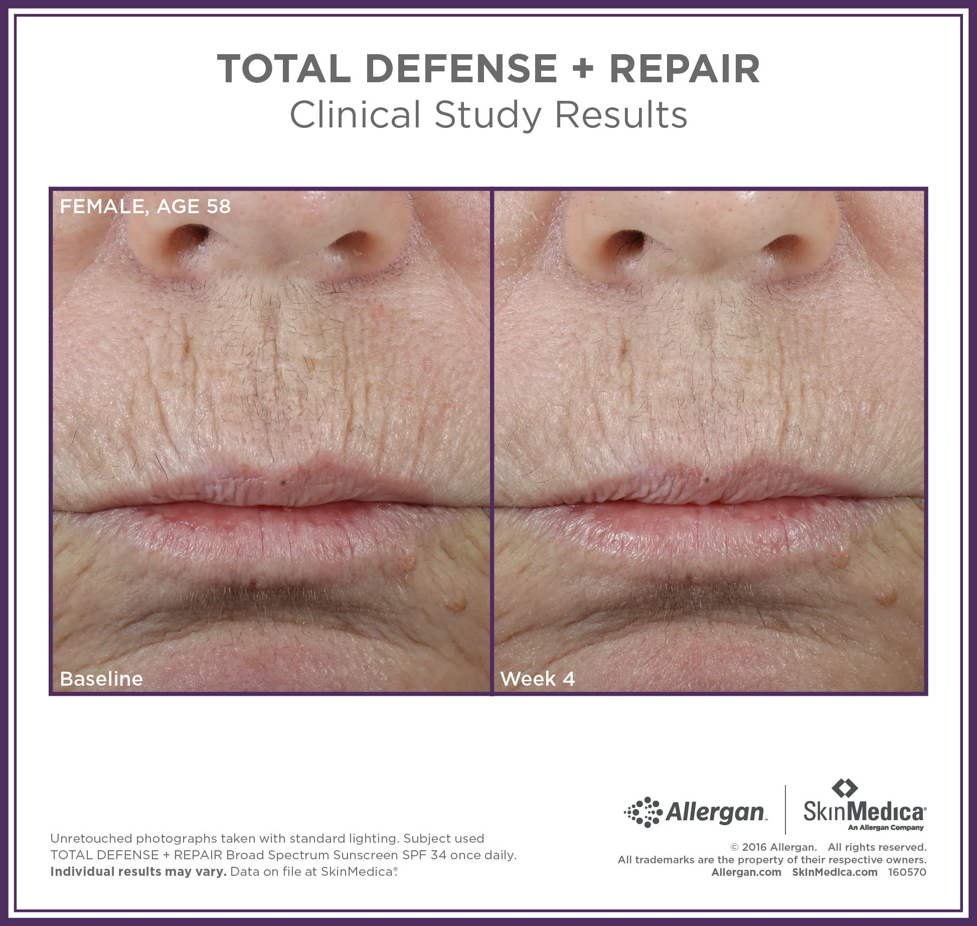 Total Defense + Repair Broad Spectrum SPF 34 Sunscreen - Image 6