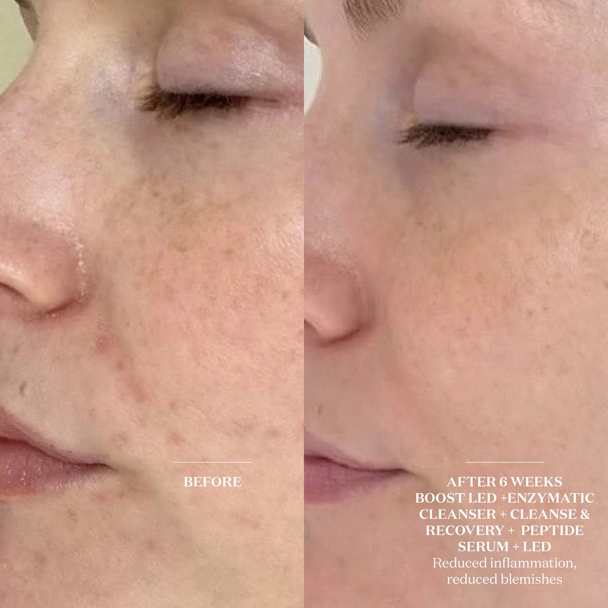 Cleanse and Recovery Spray - Image 3