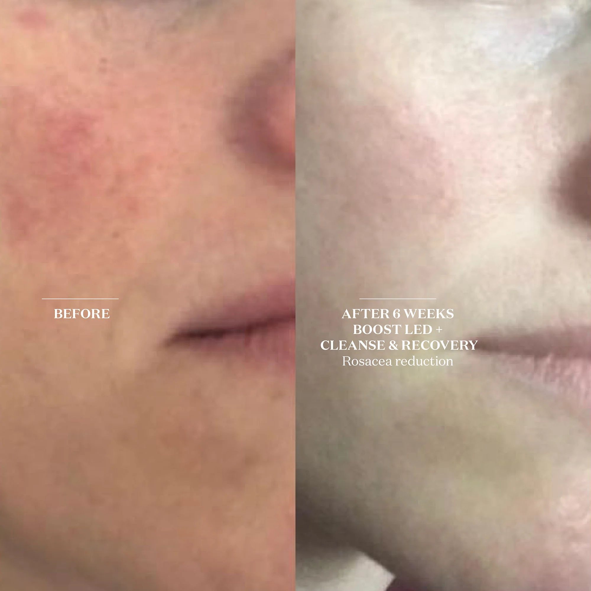 Cleanse and Recovery Spray - Image 4