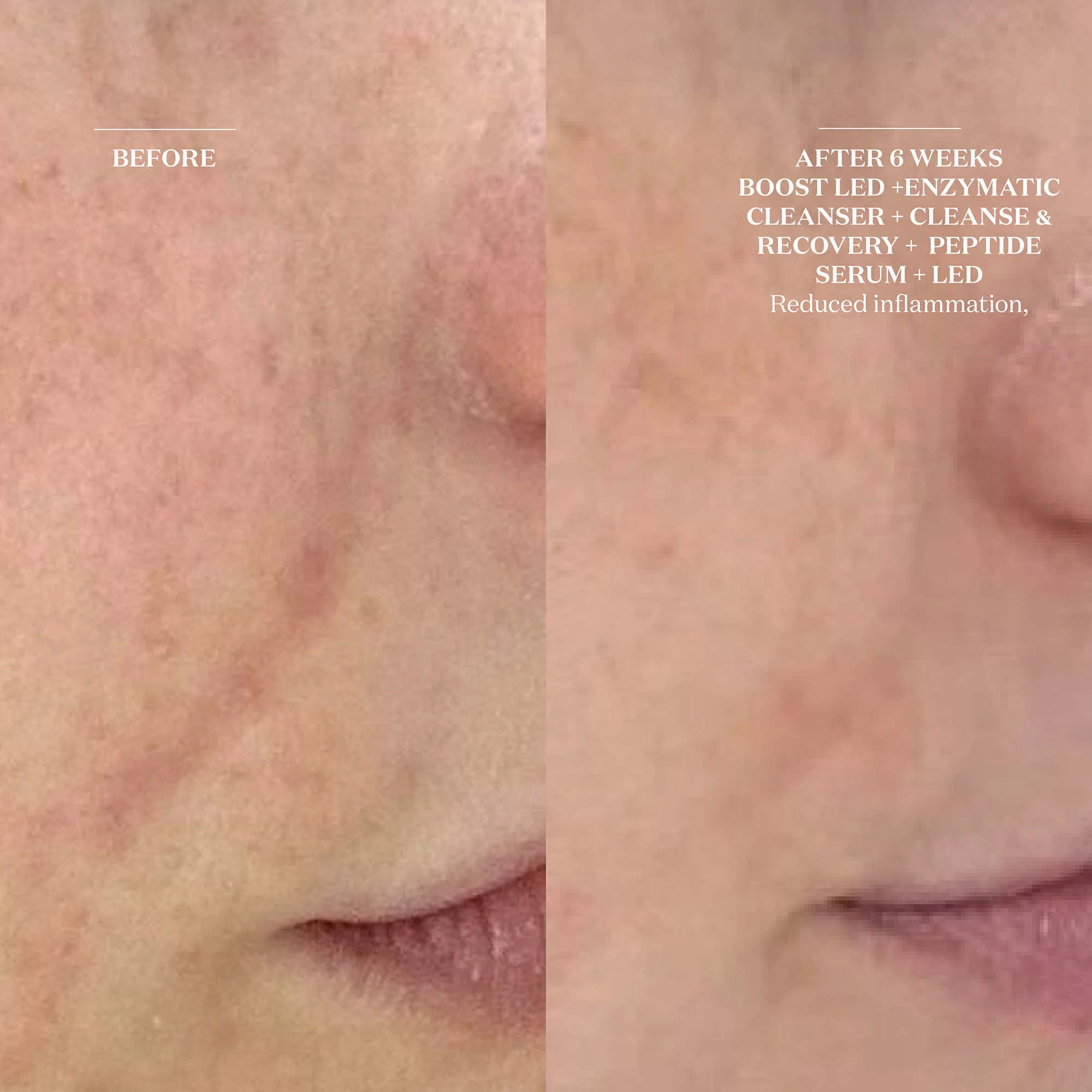 Cleanse and Recovery Spray - Image 5