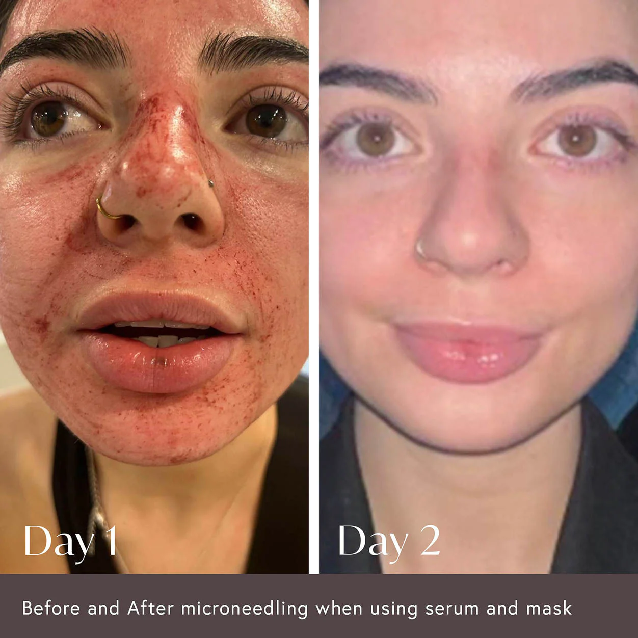 Hidden Agenda Pre and Post Injection Care Serum - Image 3