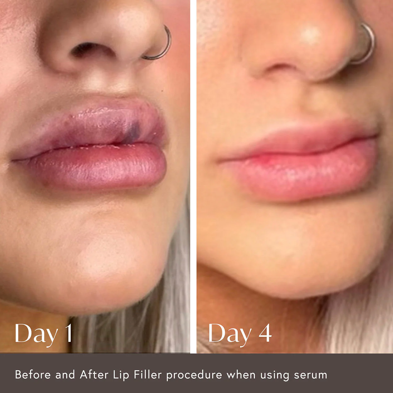 Hidden Agenda Pre and Post Injection Care Serum - Image 4