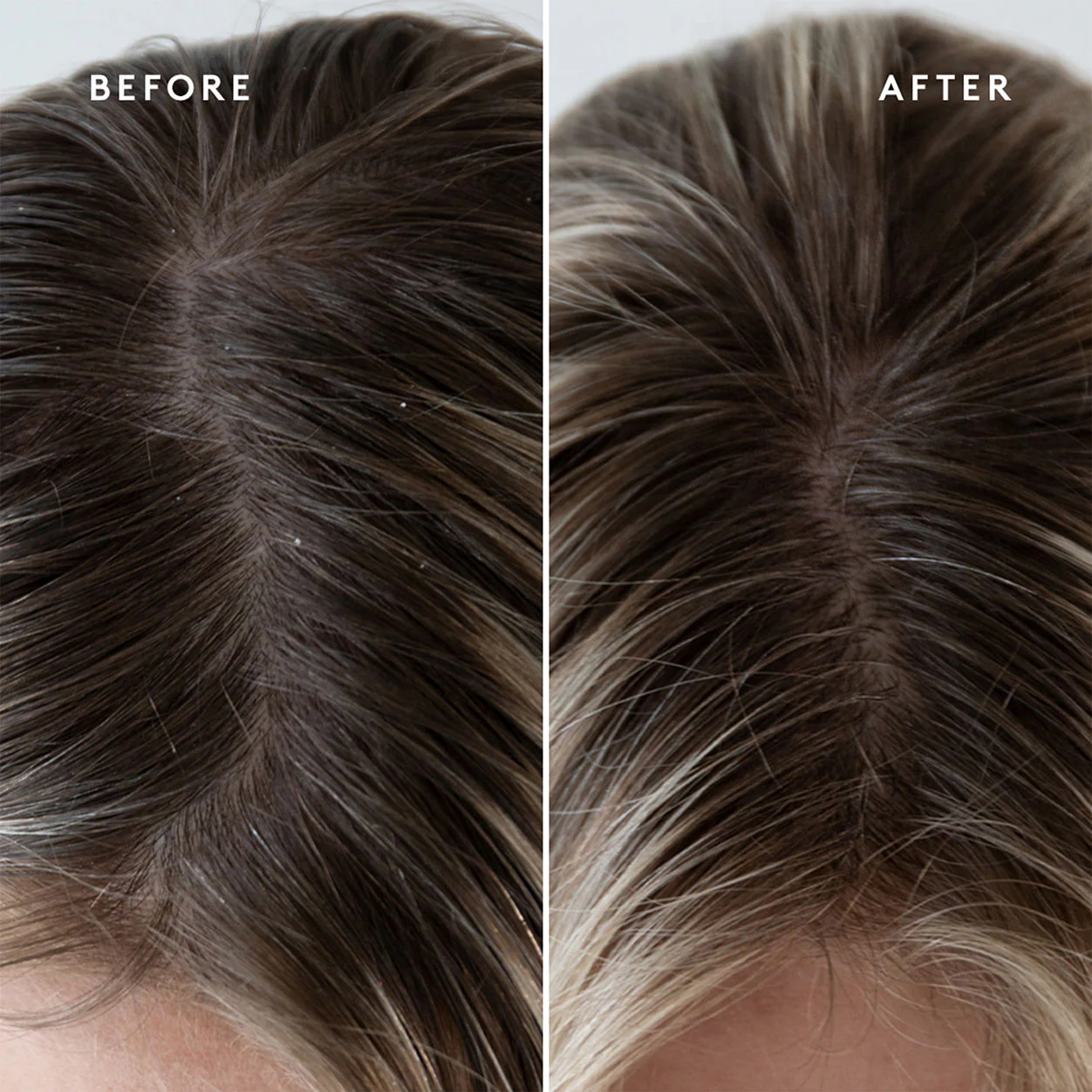 Refresh Exfoliating Scalp Treatment - Image 4