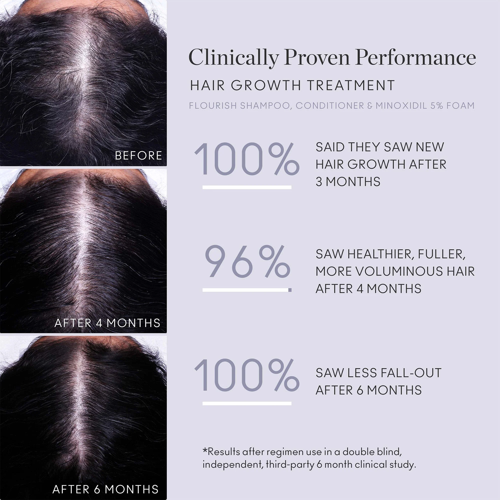 Flourish Nightly Intensive Hair Growth Treatment 30 Day - Image 4