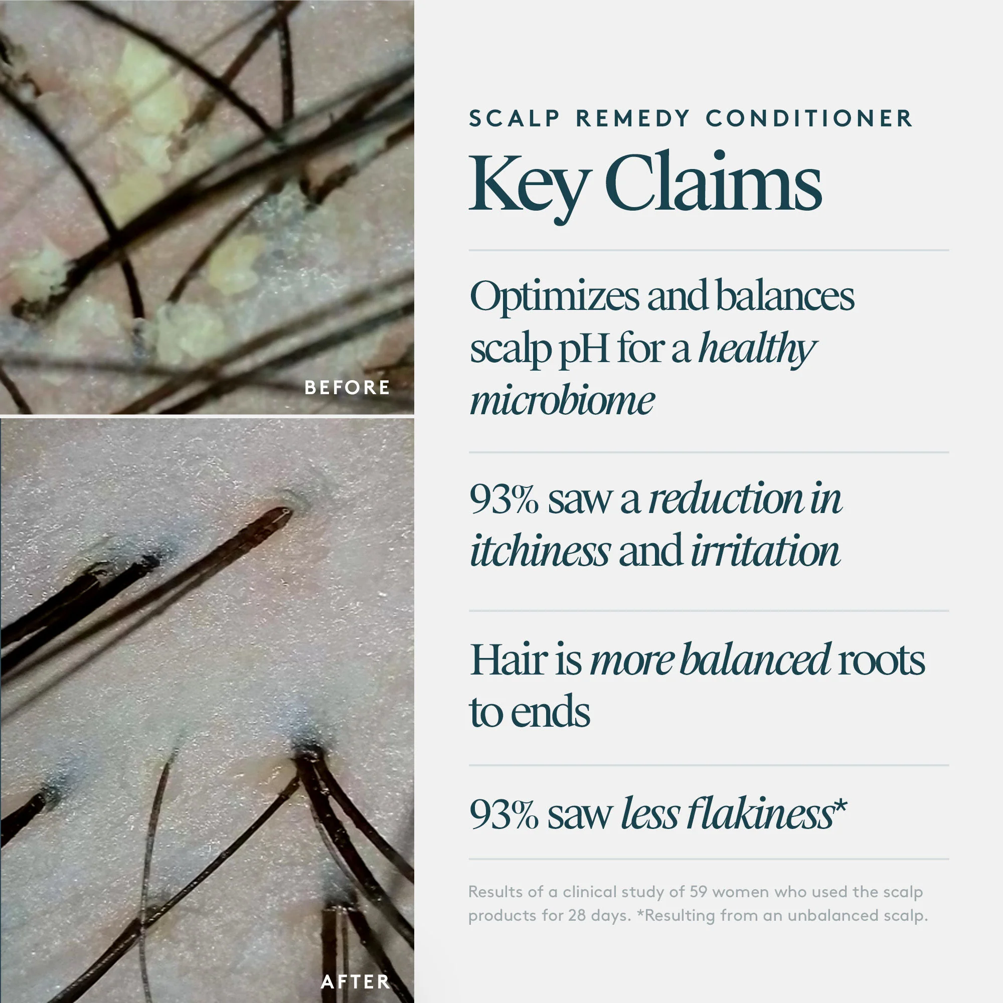 Scalp Remedy Conditioner for Scalp and Hair Health - Image 8