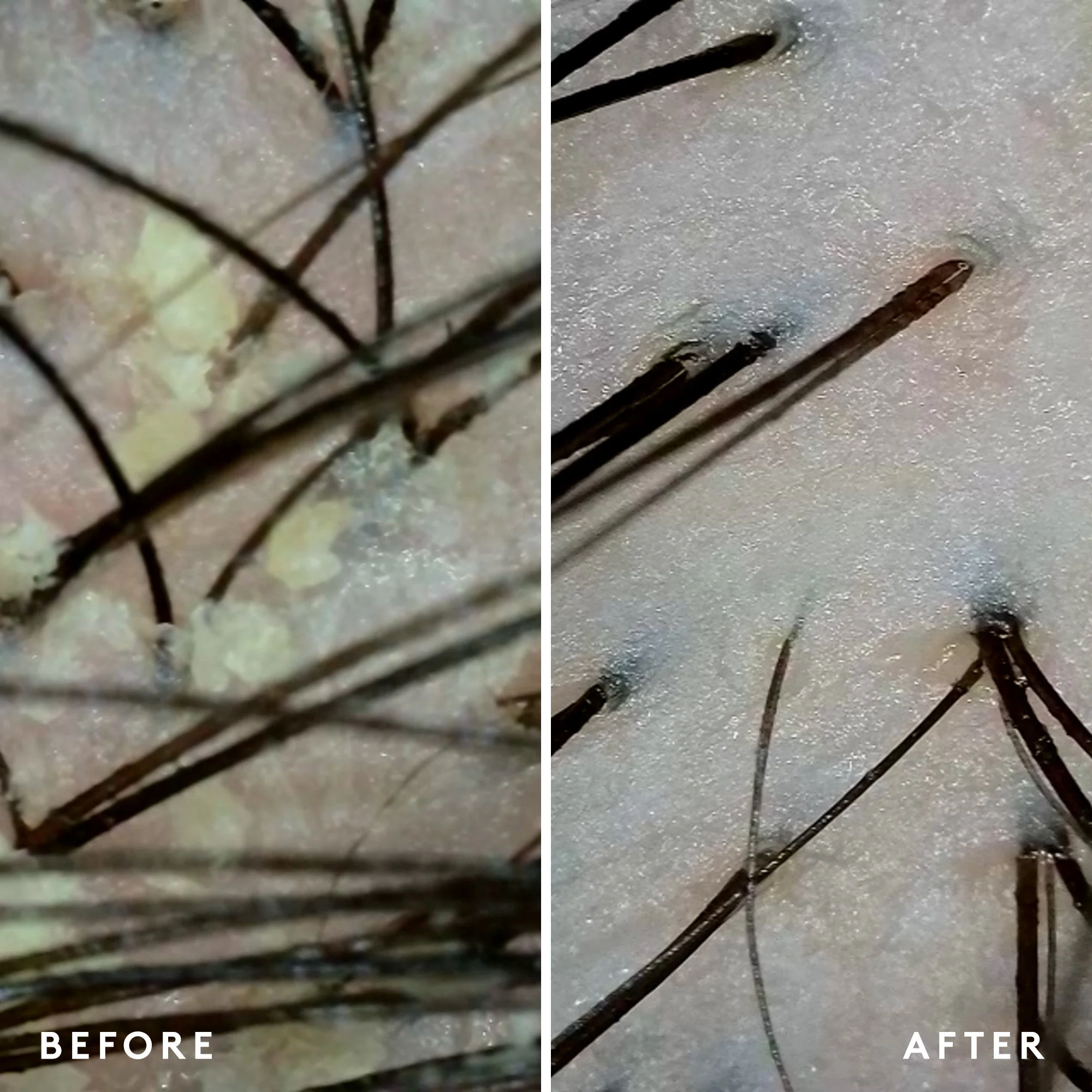 Scalp Remedy Shampoo for Scalp and Hair Health - Image 6
